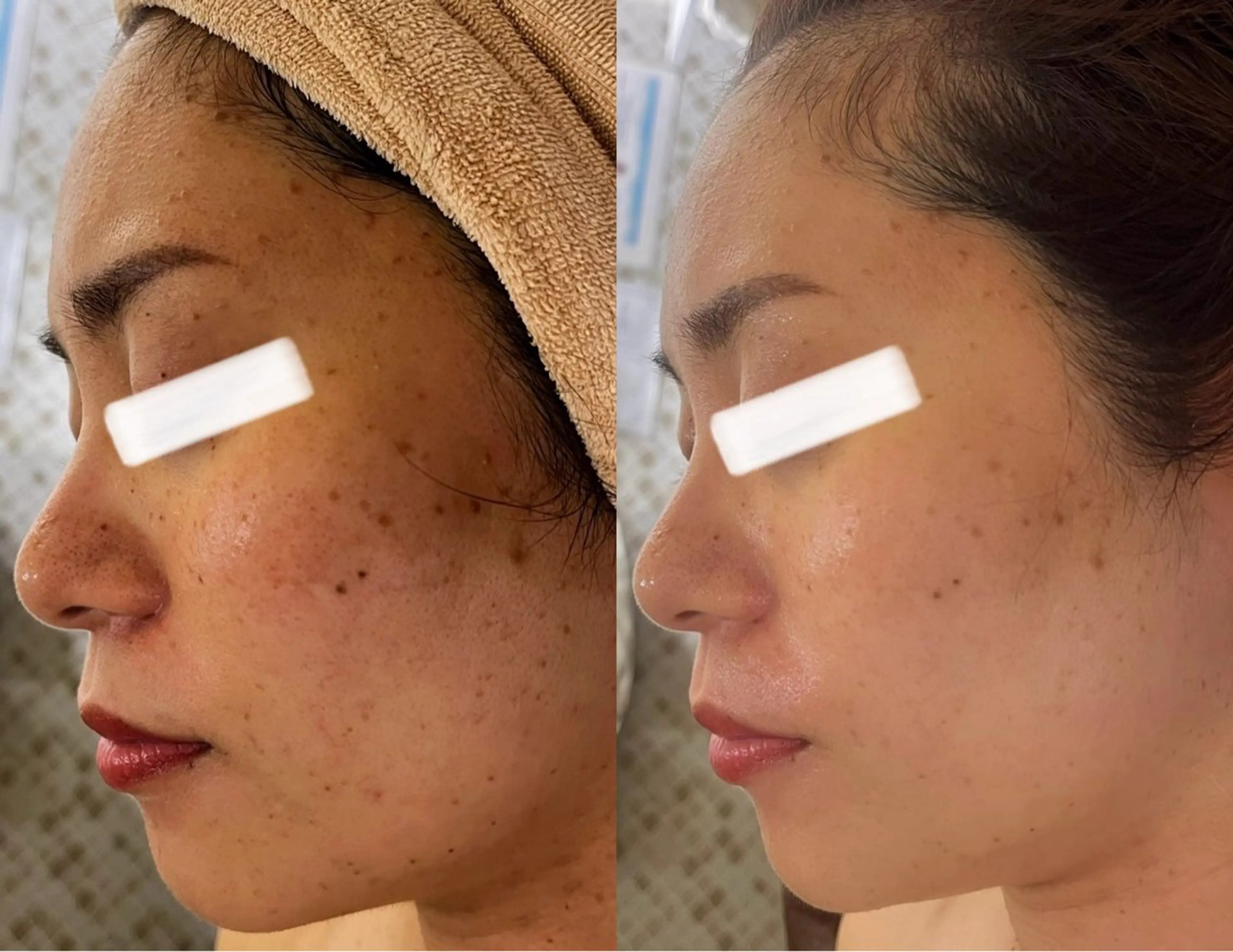 小顔&美肌品川店 Masqueradeのエステ・リラクイメージ