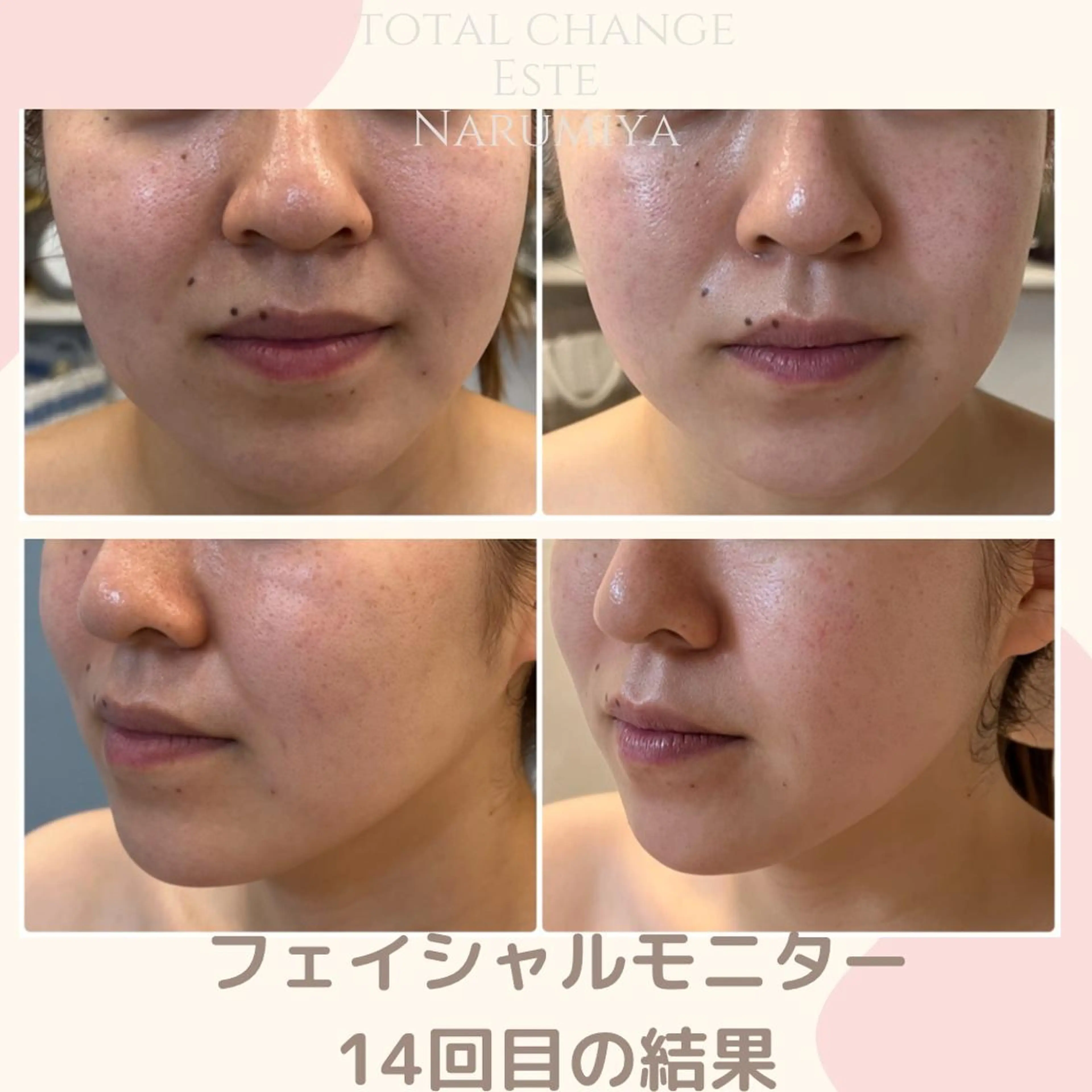 辻 佐耶のエステ・リラクイメージ