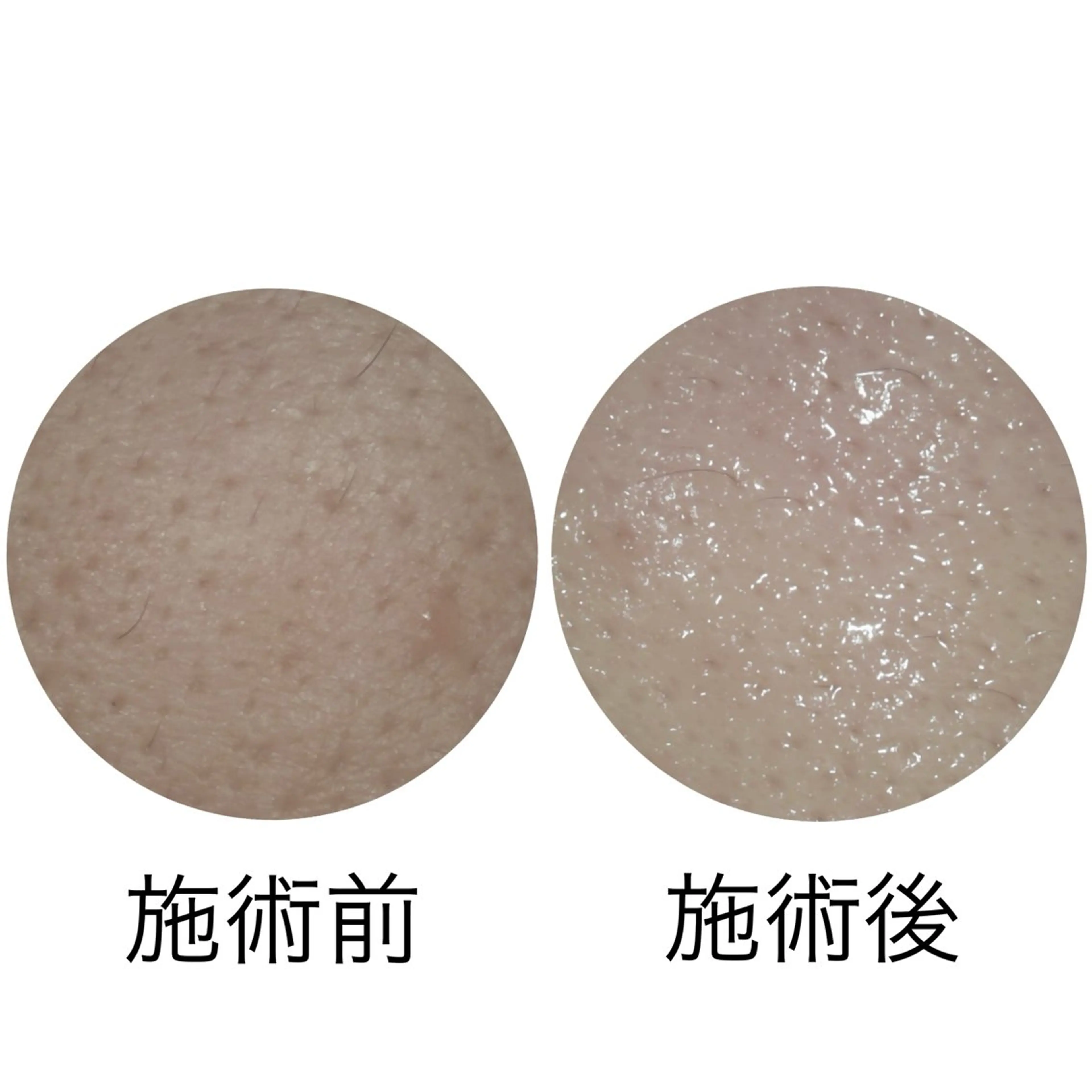 メナードフェイシャルサロン丸の内ヒルズ所属・メナード丸の内ヒルズ 柳田りさのエステ・リラクイメージ