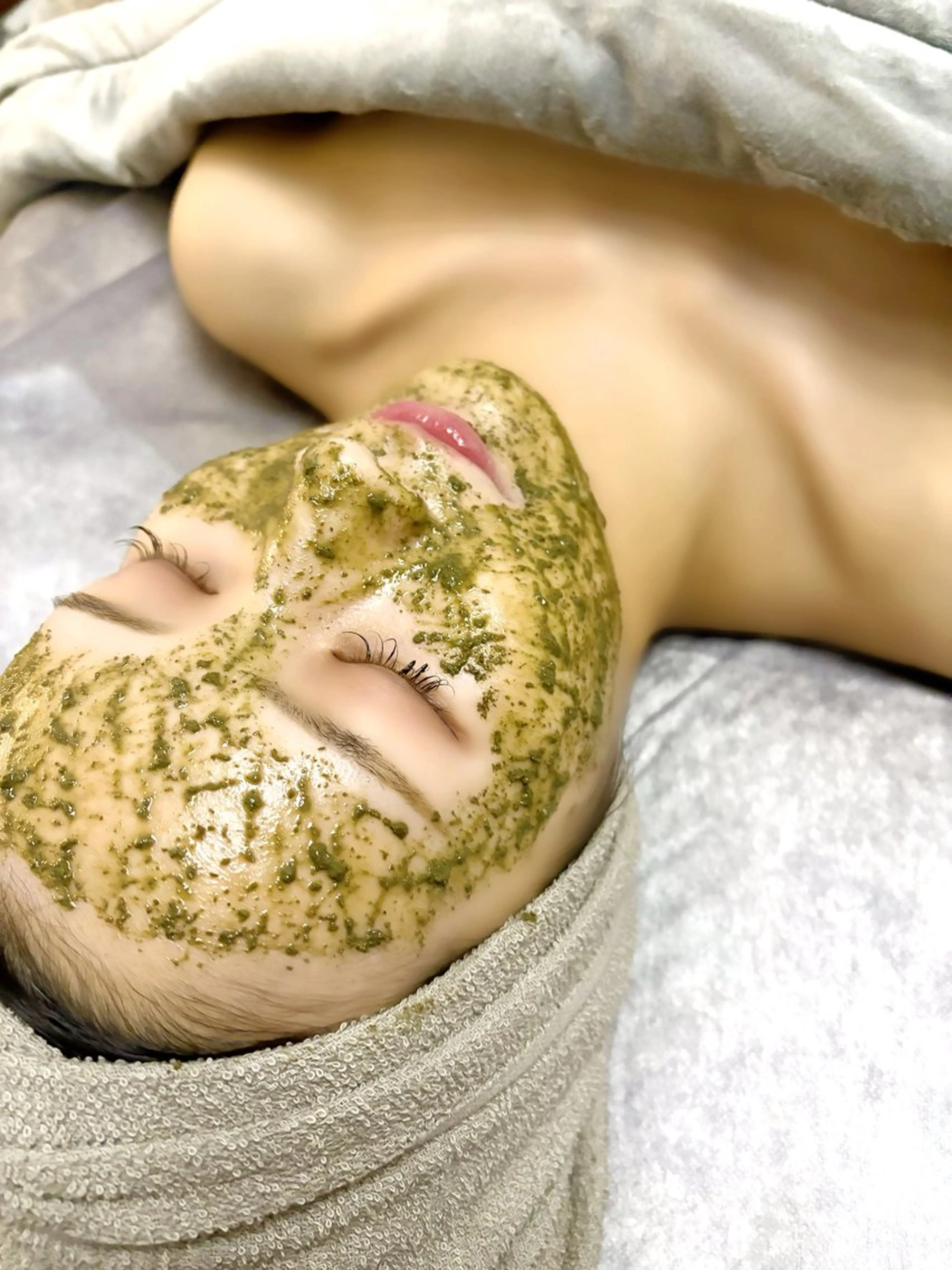 【ニキビ悩みに】ハーブピーリングの写真