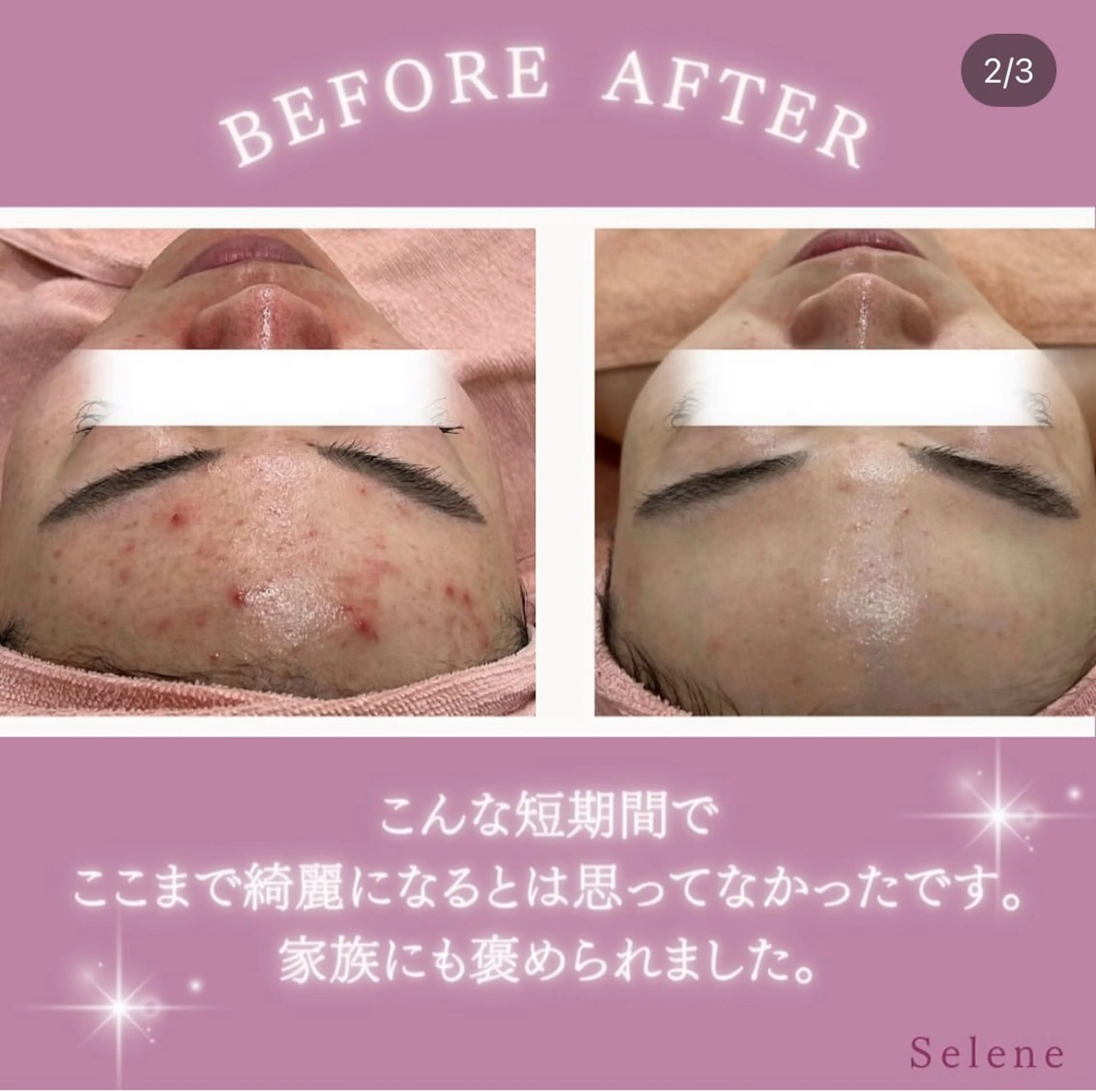 エステ 【現役看護師】高来 笑子のエステ・リラクイメージ