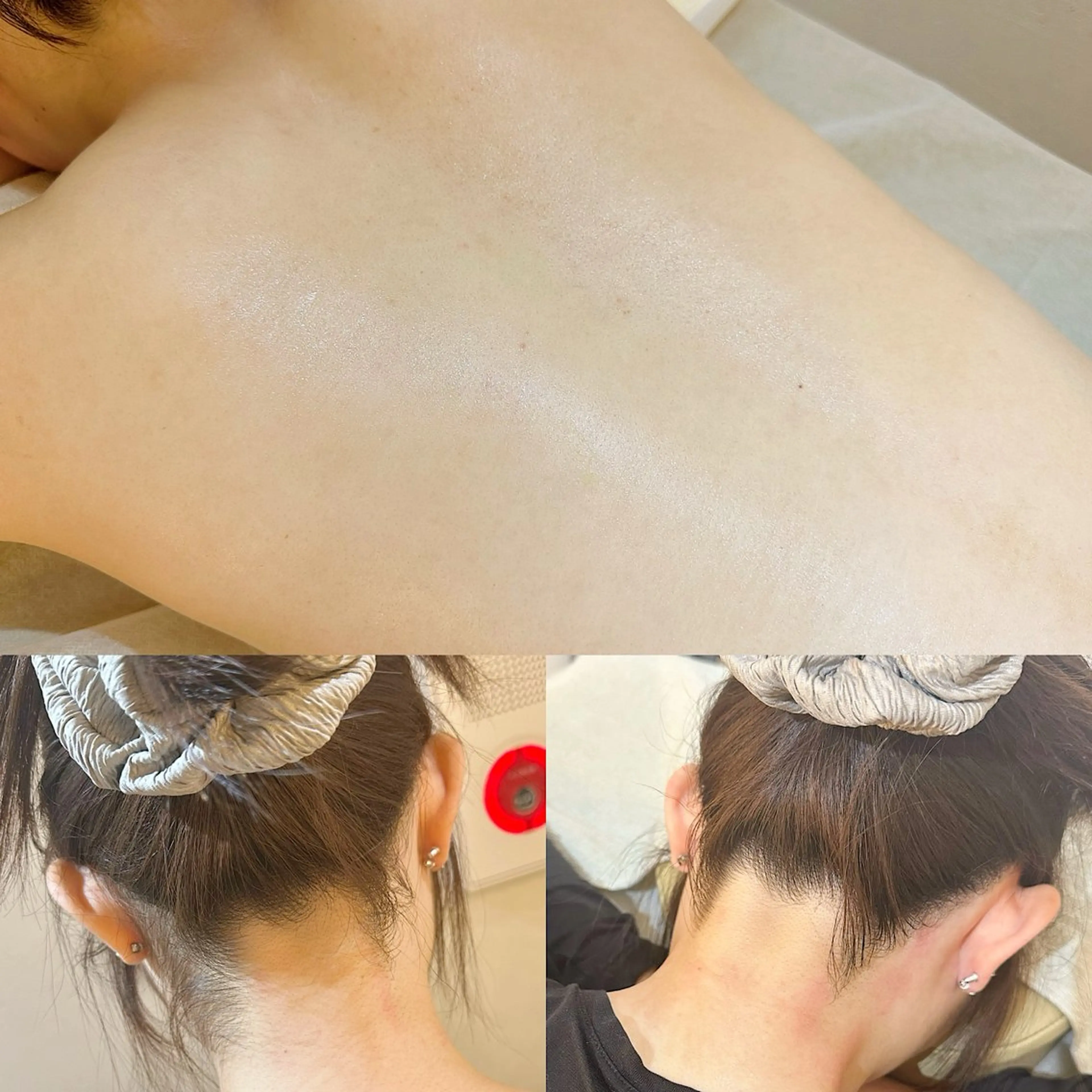 うなじ脱毛/美肌脱毛 LABELのエステ・リラクイメージ