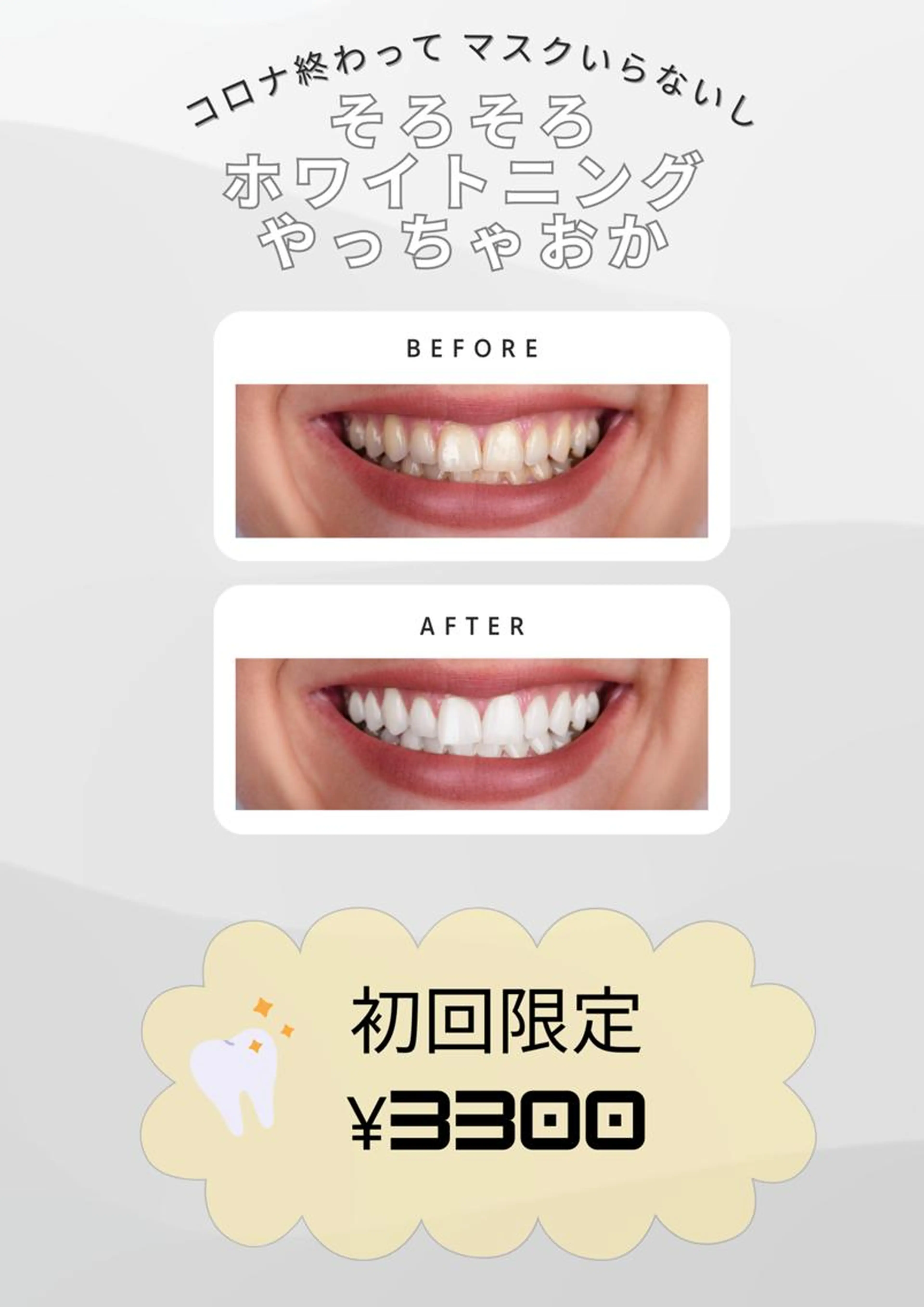 【医療用薬剤使用!】セルフホワイトニング 初回3300円の写真