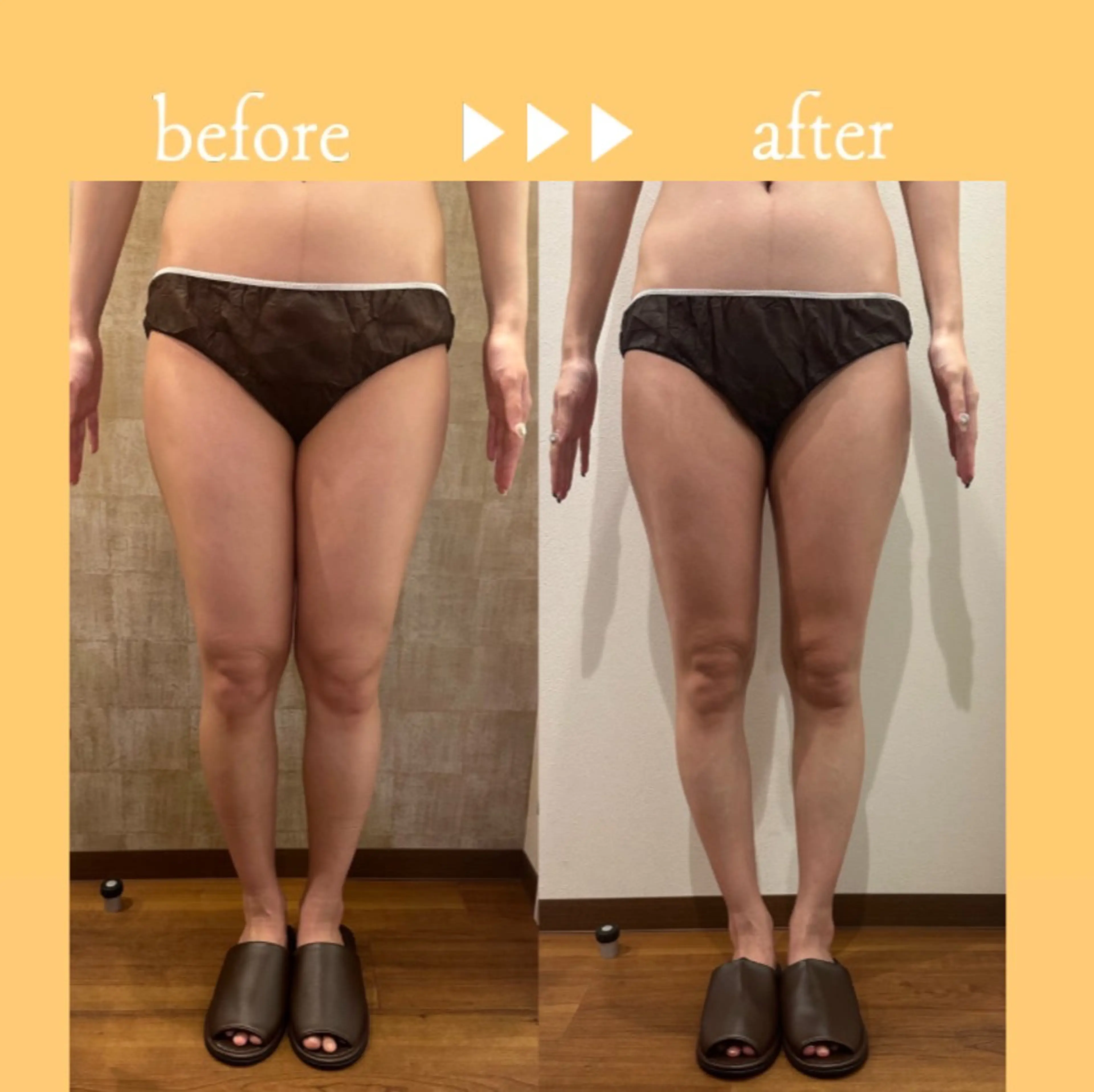 🎀葛野 日向子🎀のエステ・リラクイメージ