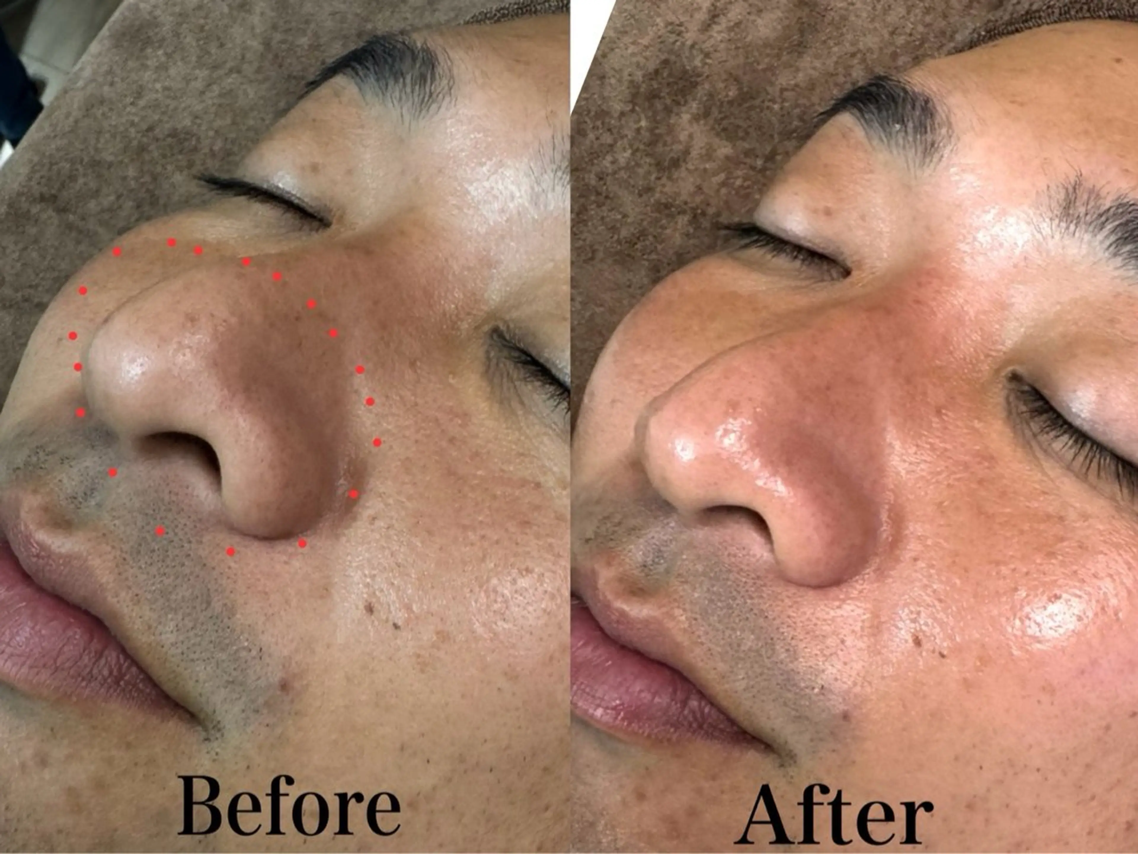 エステ 六本木脱毛andS 店長Sachiのエステ・リラクイメージ