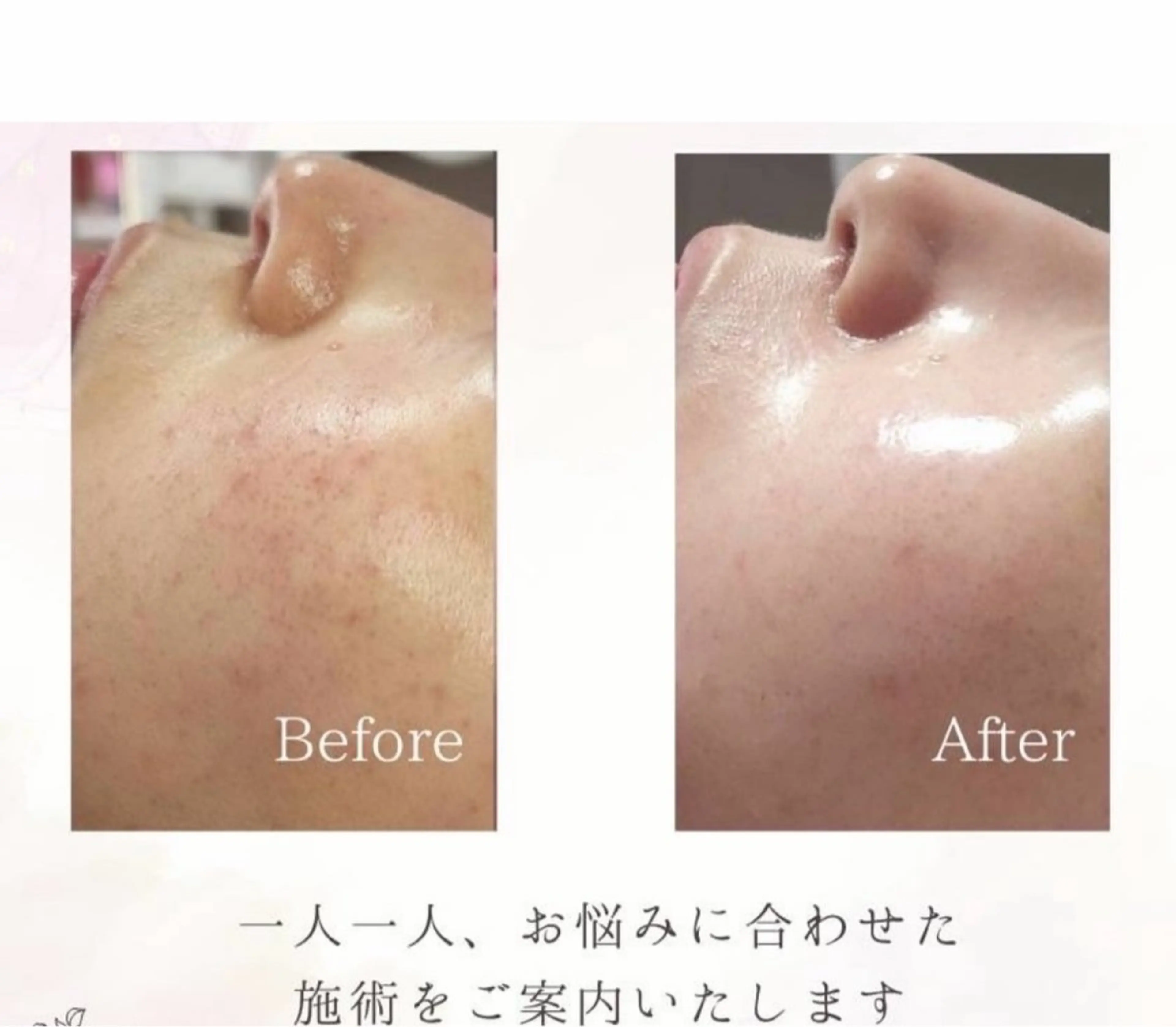 痩身専門サロン マハロミのエステ・リラクイメージ