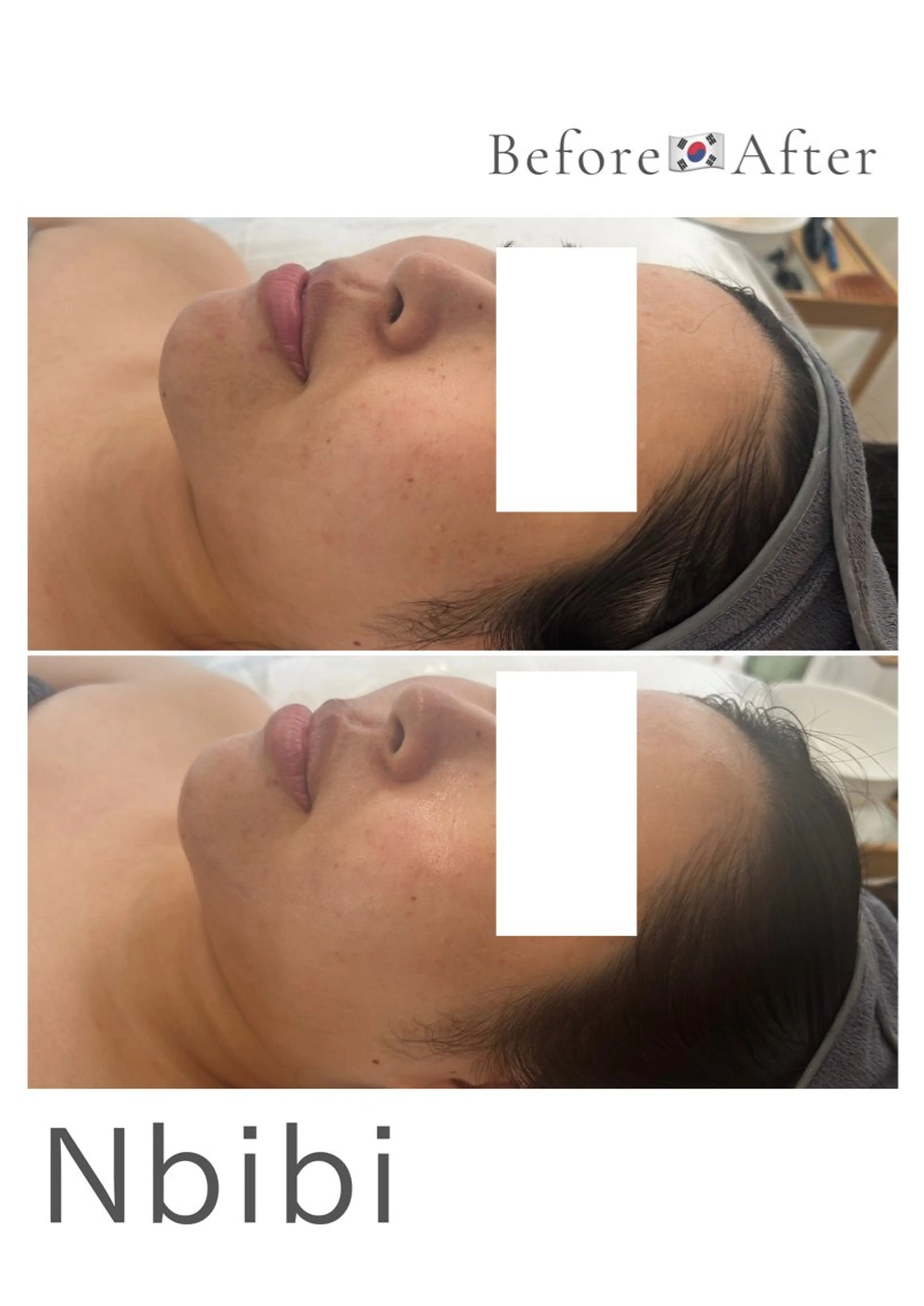 韓国🇰🇷価格 サロン_Nbibiのエステ・リラクイメージ