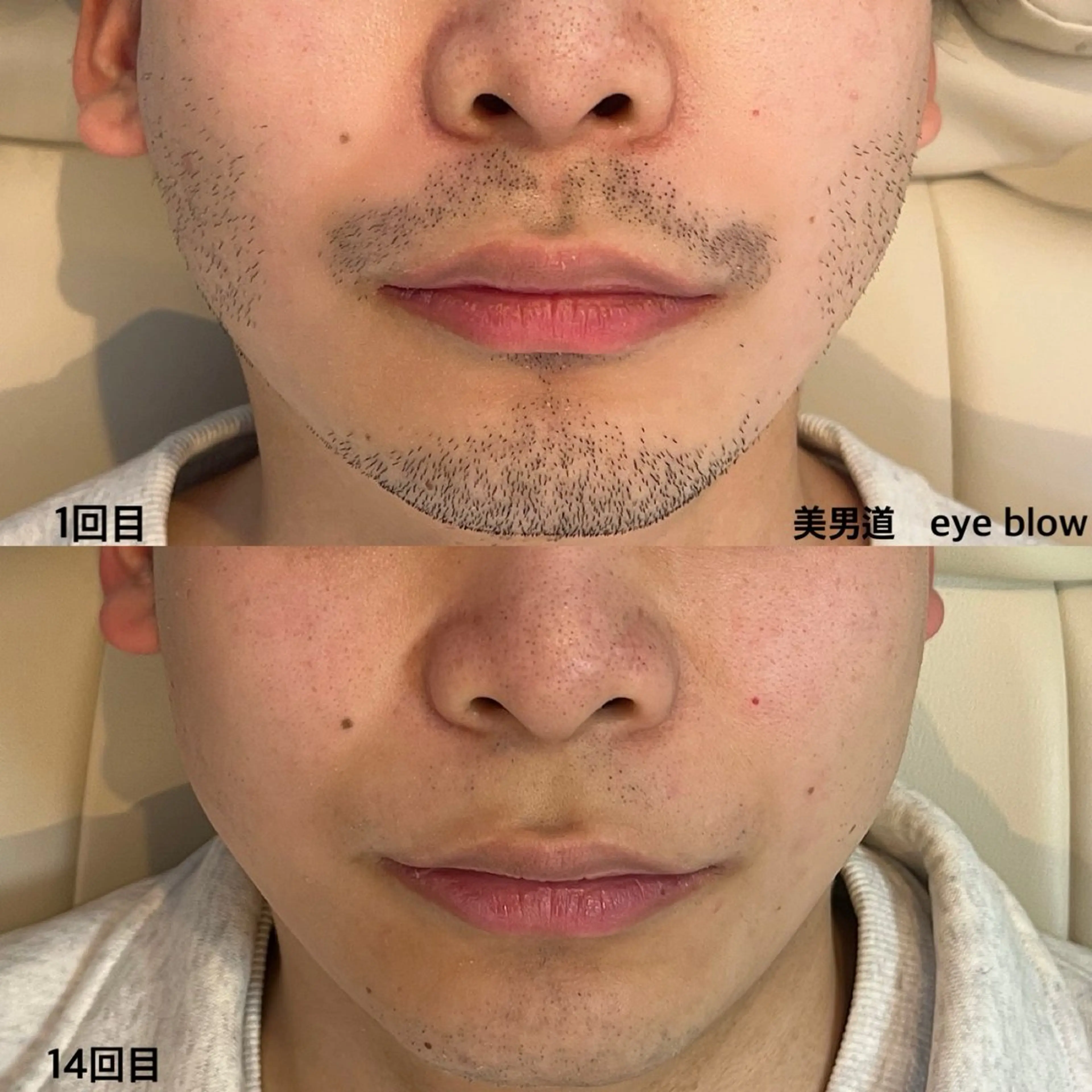 メンズ 脱毛 BINANDO 桑原の眉毛・アイブロウイメージ