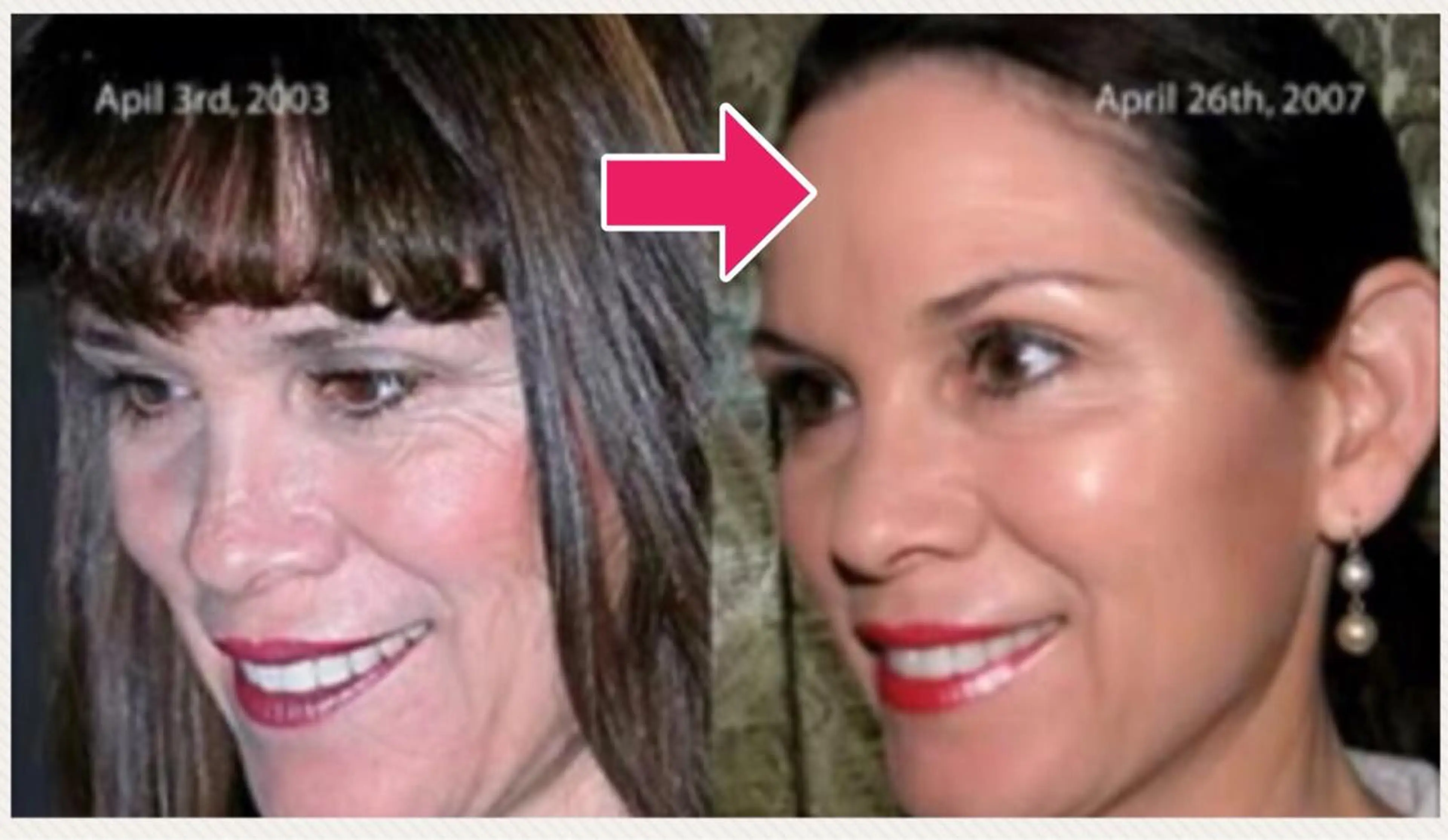 体験‼️最新美容機器エイジングケア体験45分の写真