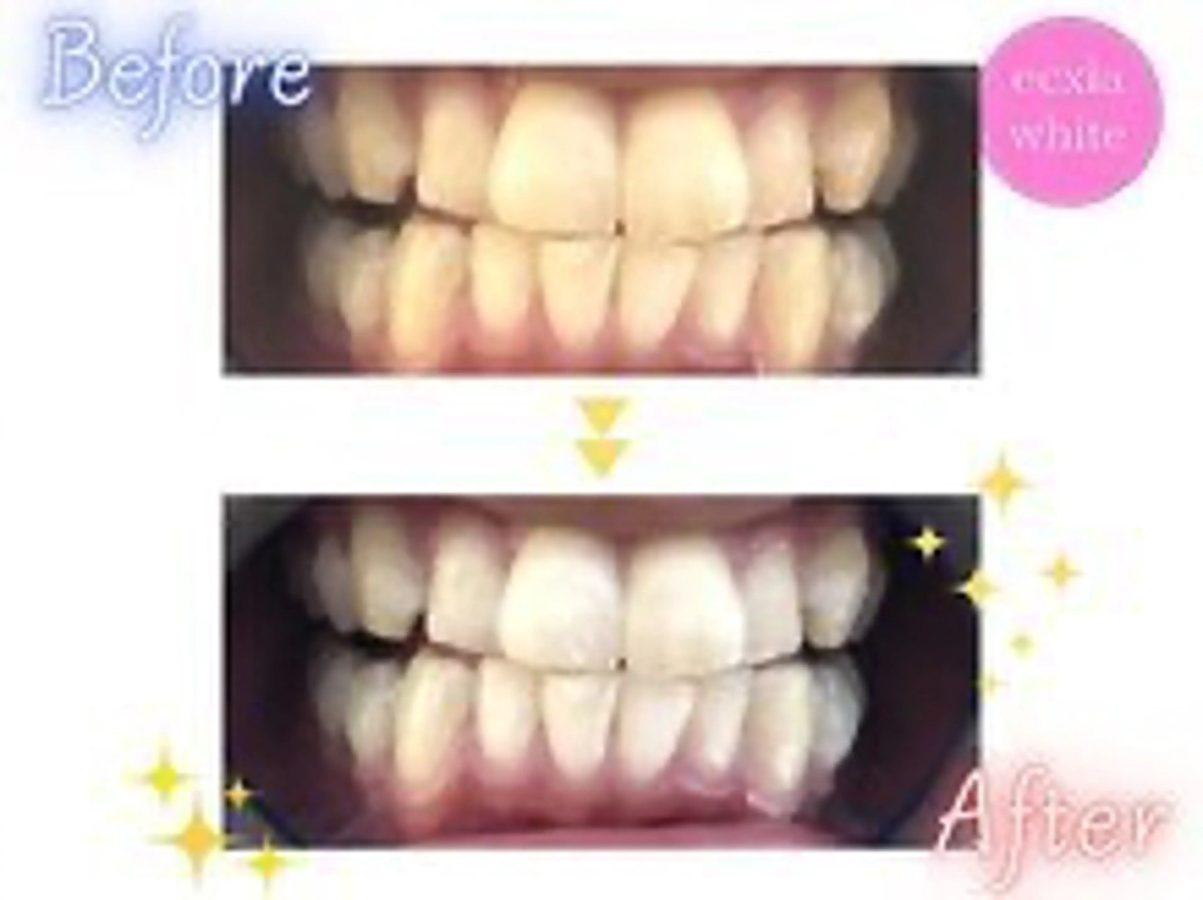 セルフホワイトニング エクシア西宮北口店所属・セルフホワイトニング エクシア西宮北口店のその他イメージ