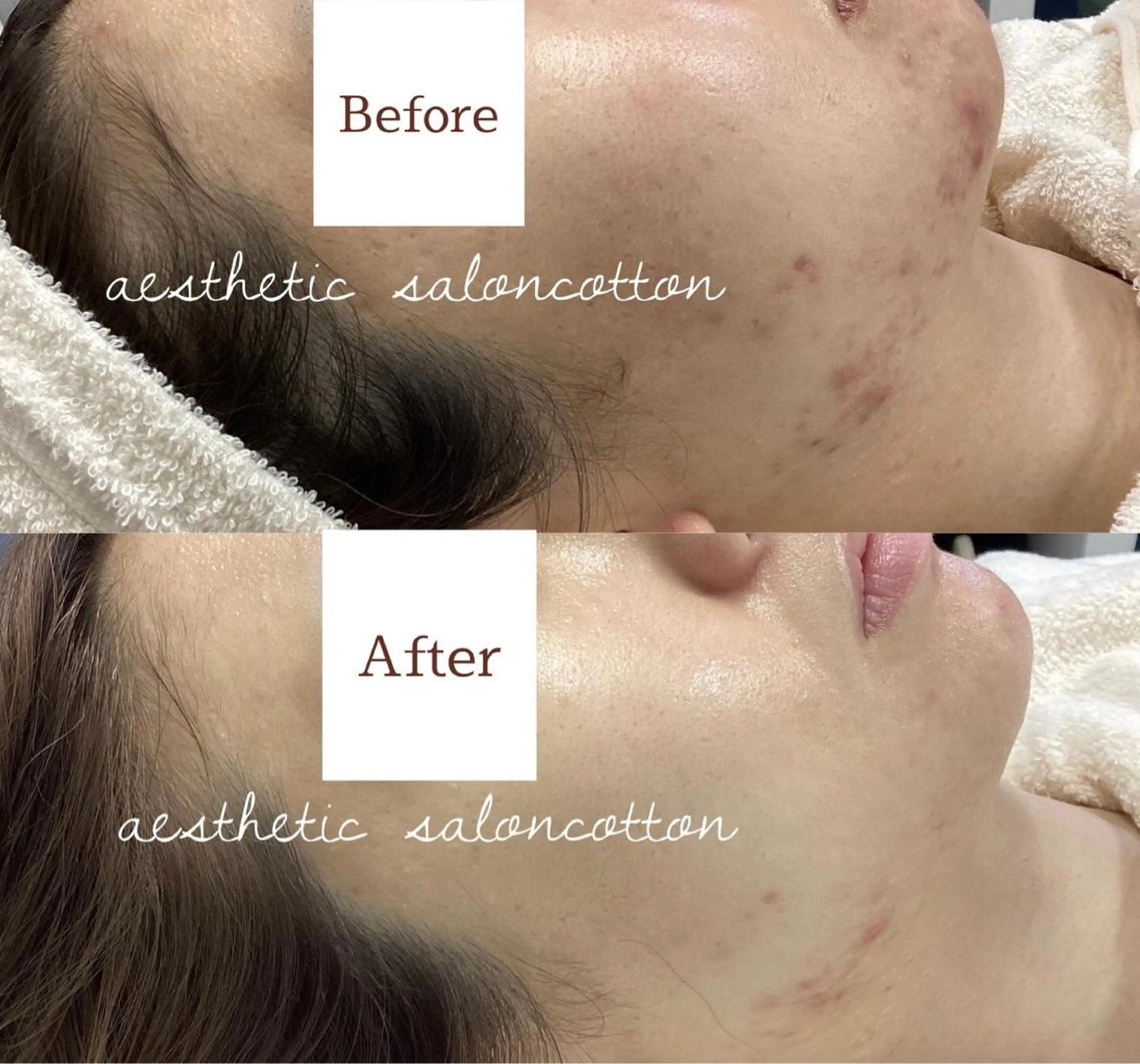 都度払い 肌質改善専門サロンのエステ・リラクイメージ