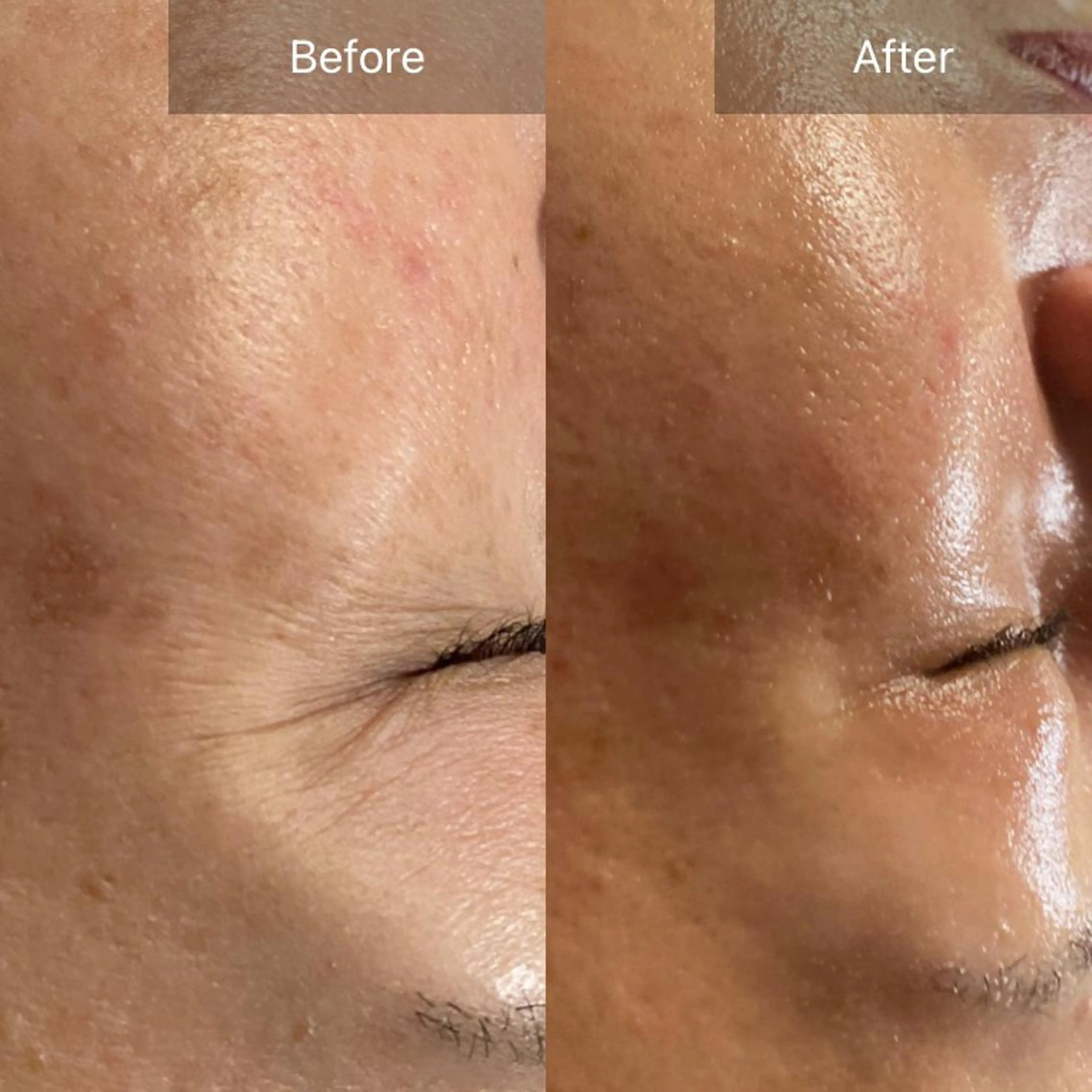 Mandarin Orange所属・毛穴から始める肌メン テマンダリンオレンジのエステ・リラクイメージ