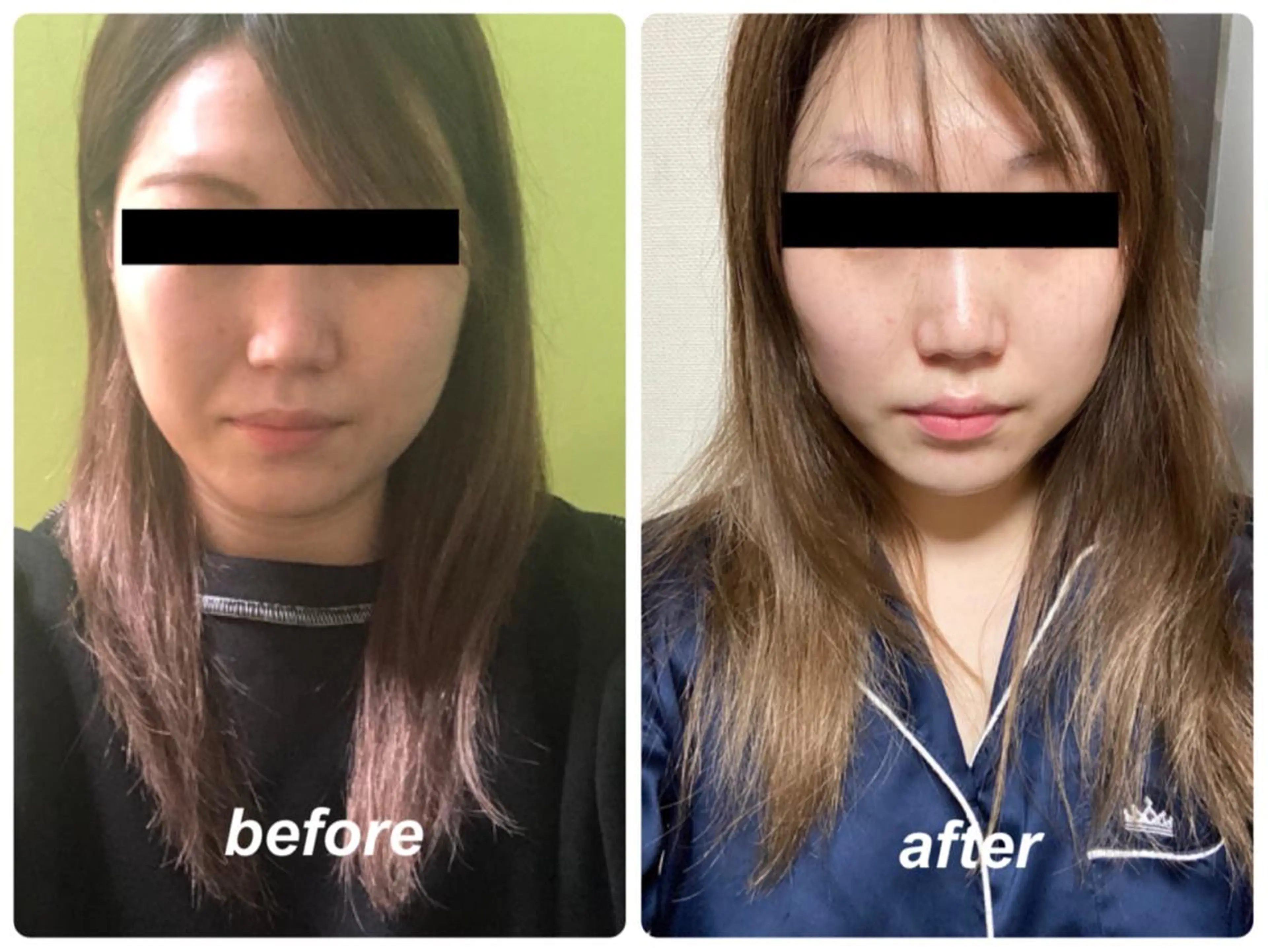 Radiance H.Oのエステ・リラクイメージ