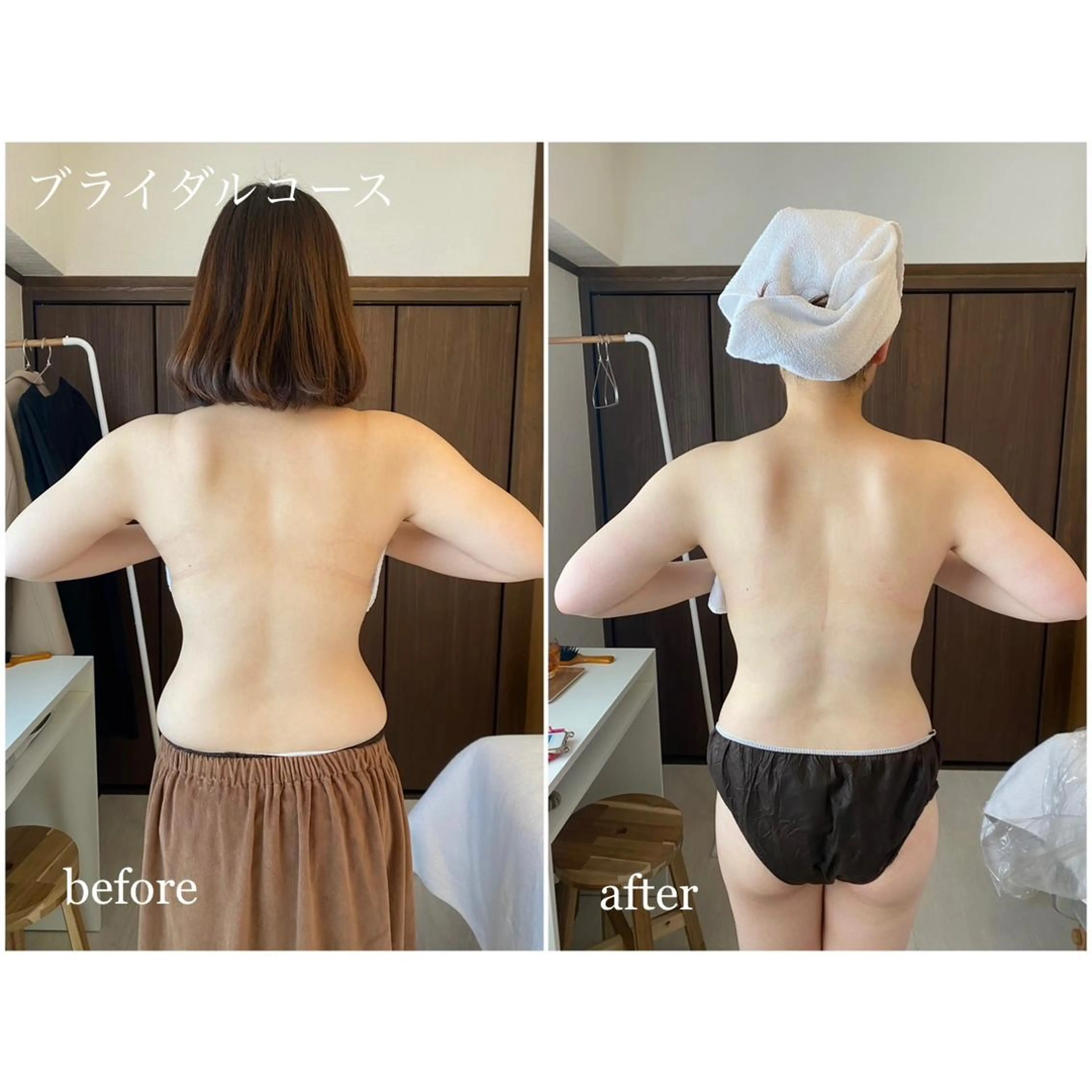 I'm -ｲﾑ-所属・肌質改善／ブライダル I'm.-イム-のエステ・リラクイメージ