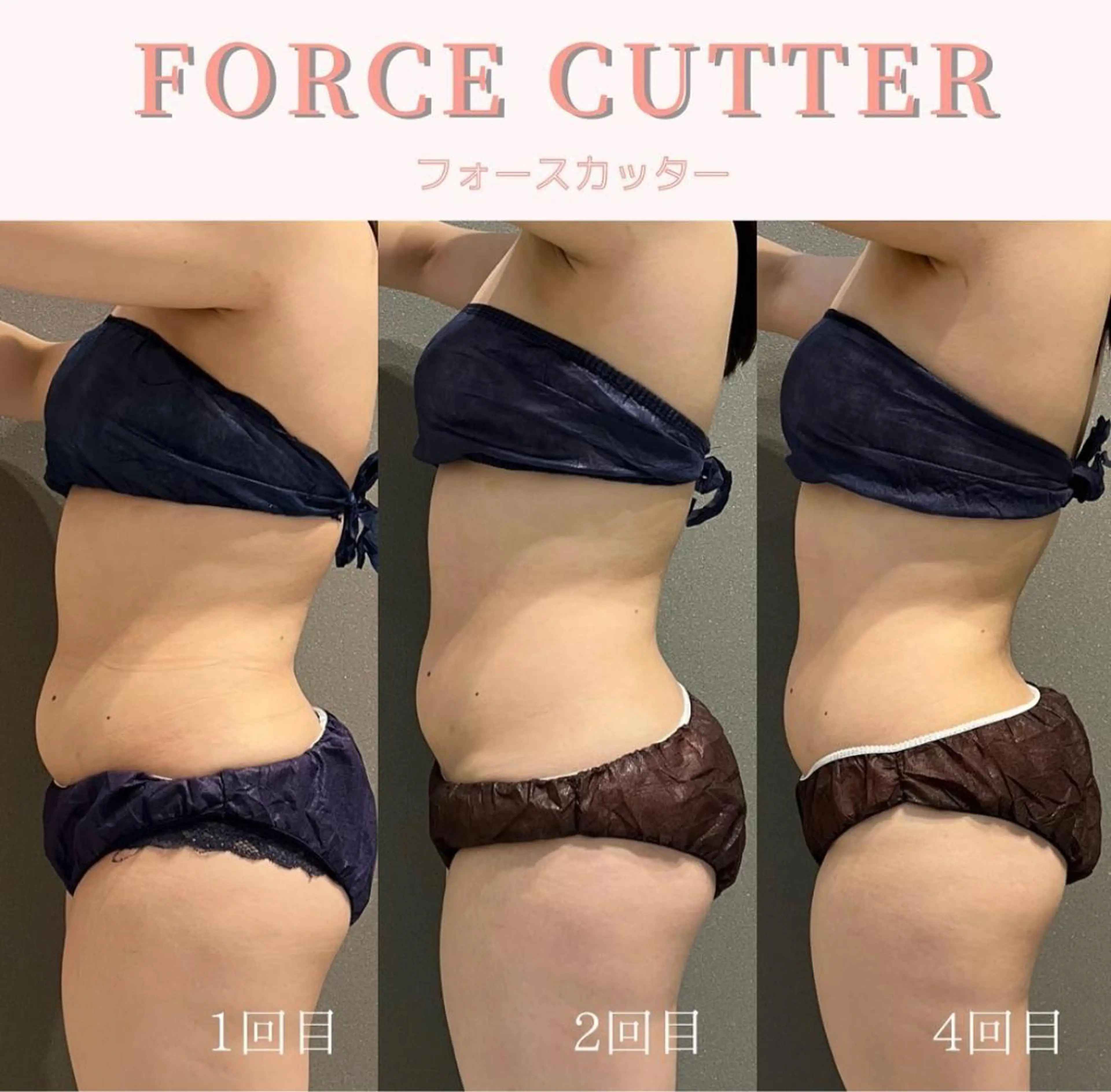 エステ リラク Hu.ruana AWANOのエステ・リラクイメージ