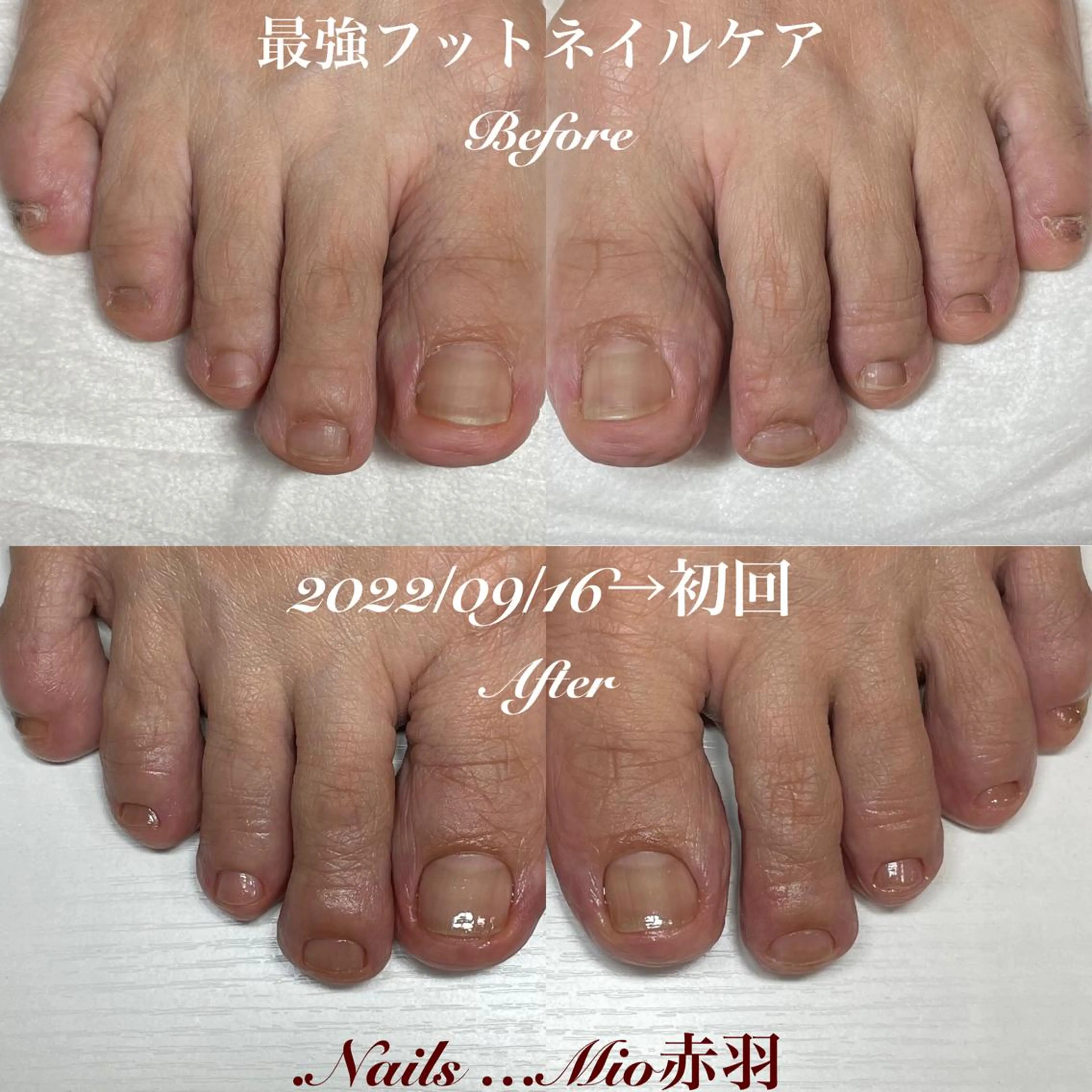 ネイル フットネイル フットネイル .Nails Mio 赤羽西ネイルサロンのネイルデザイン