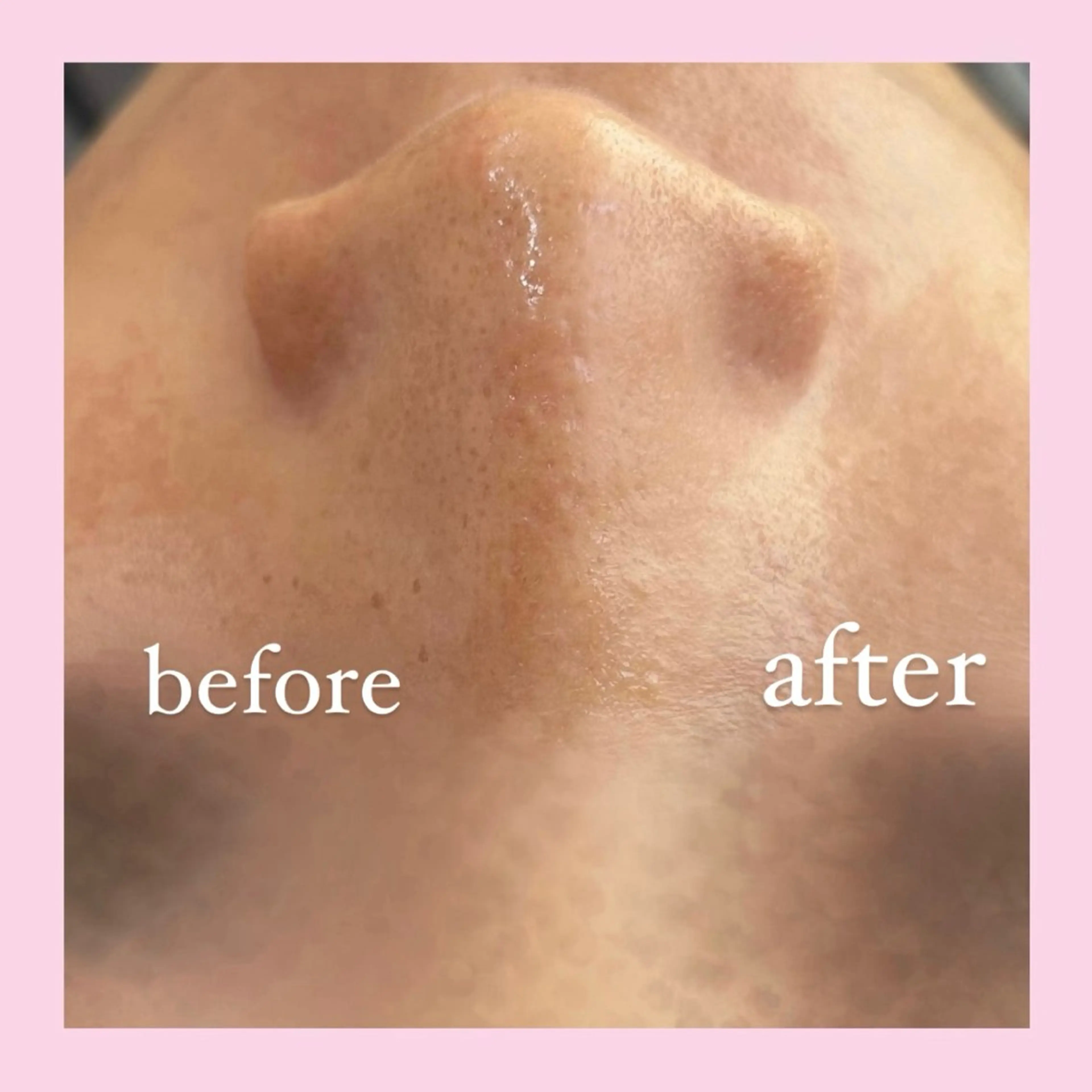 エステ 韓国肌管理専門店　White labo 宝塚店所属・有川 凜のエステ・リラクイメージ