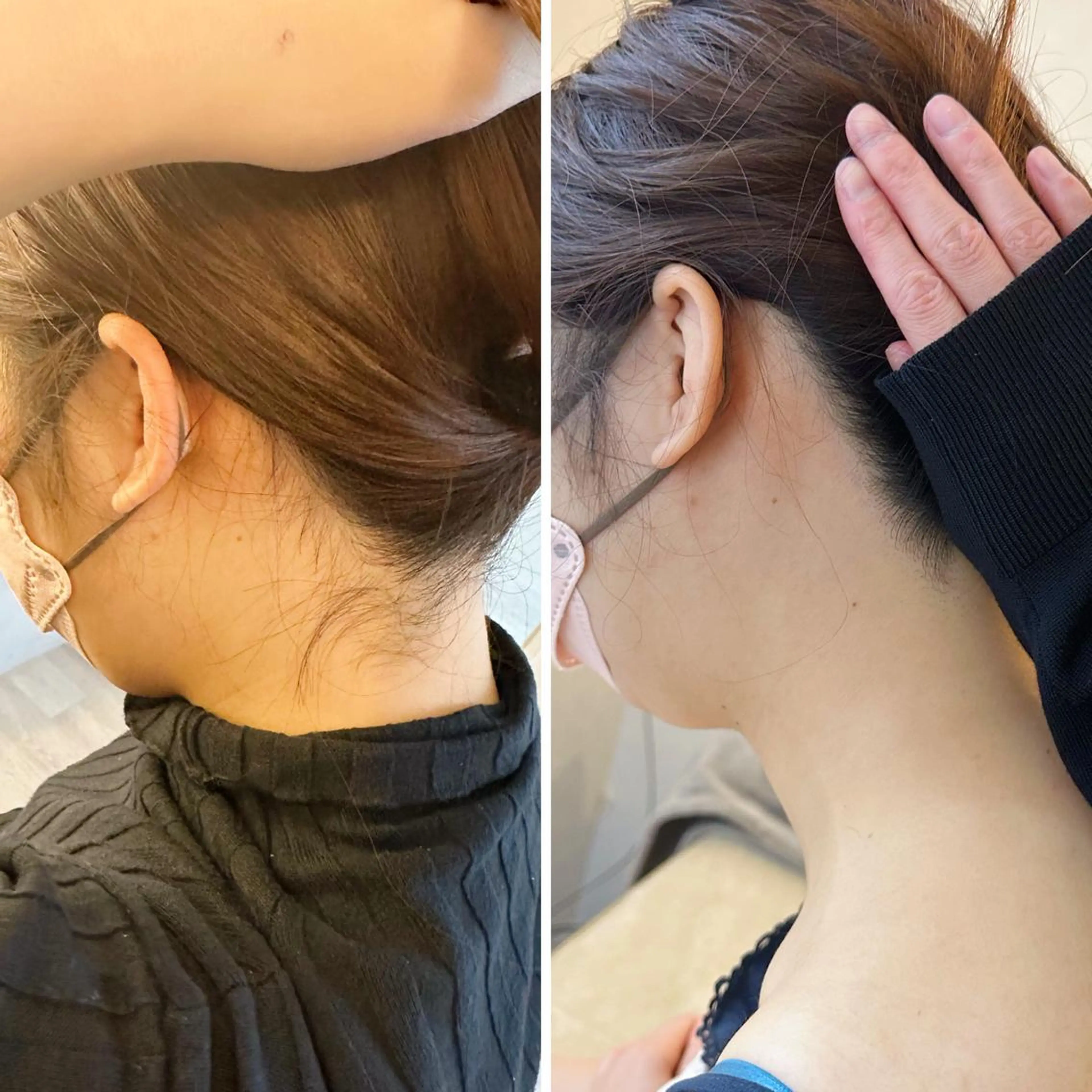 うなじ脱毛/美肌脱毛 LABELのエステ・リラクイメージ