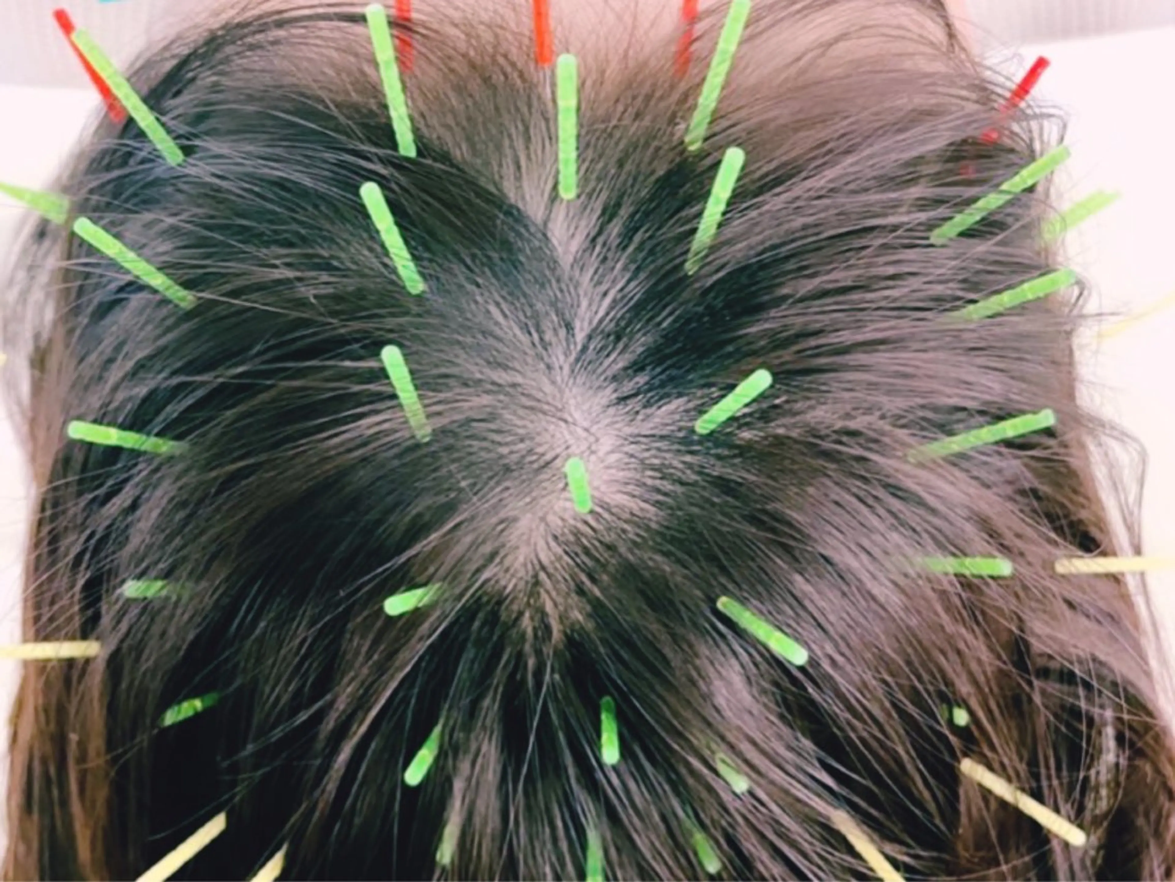 小顔美容鍼専門サロン 渋谷YZのエステ・リラクイメージ