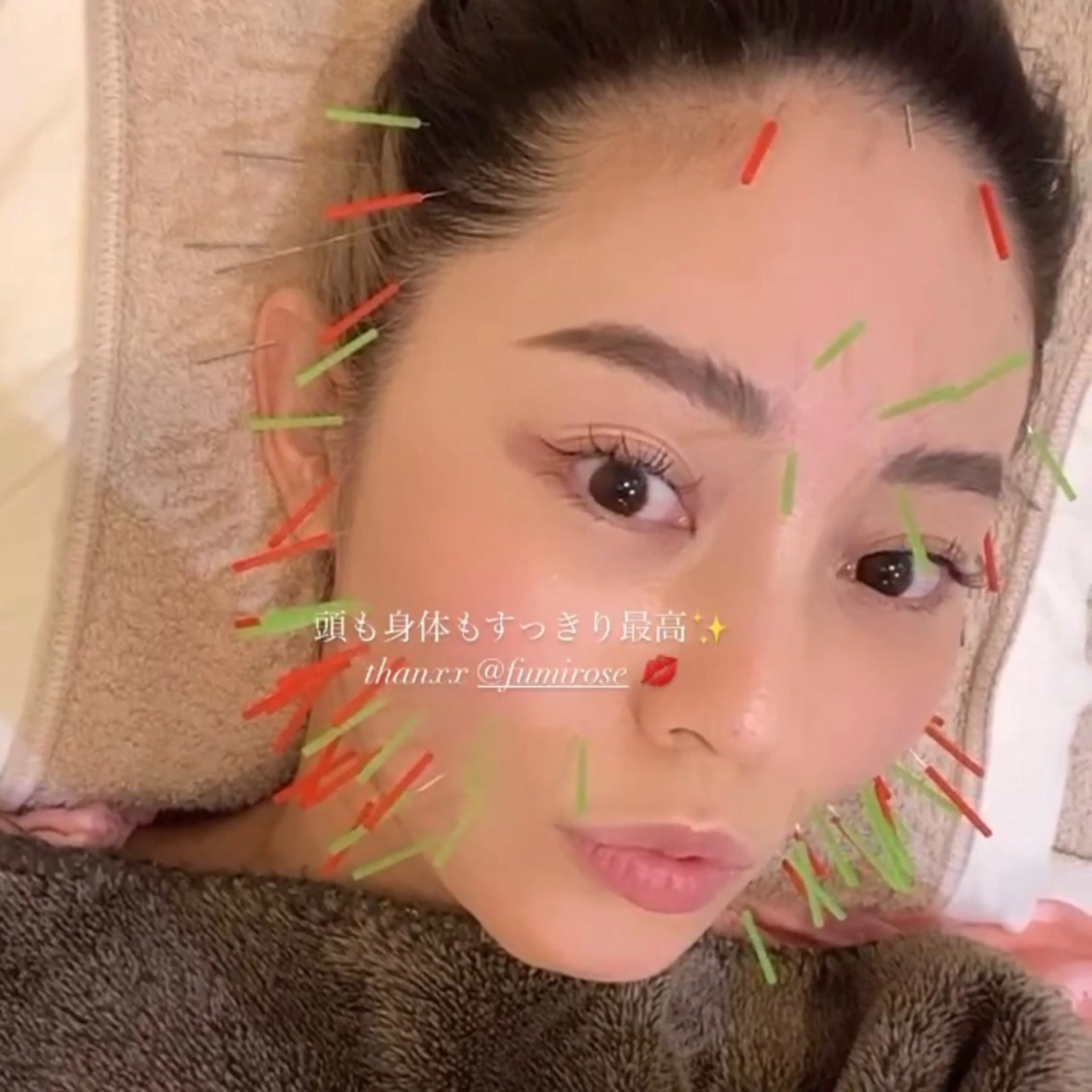 THE  ROOTS所属・美容鍼♡小顔矯正♡ fumikaのエステ・リラクイメージ