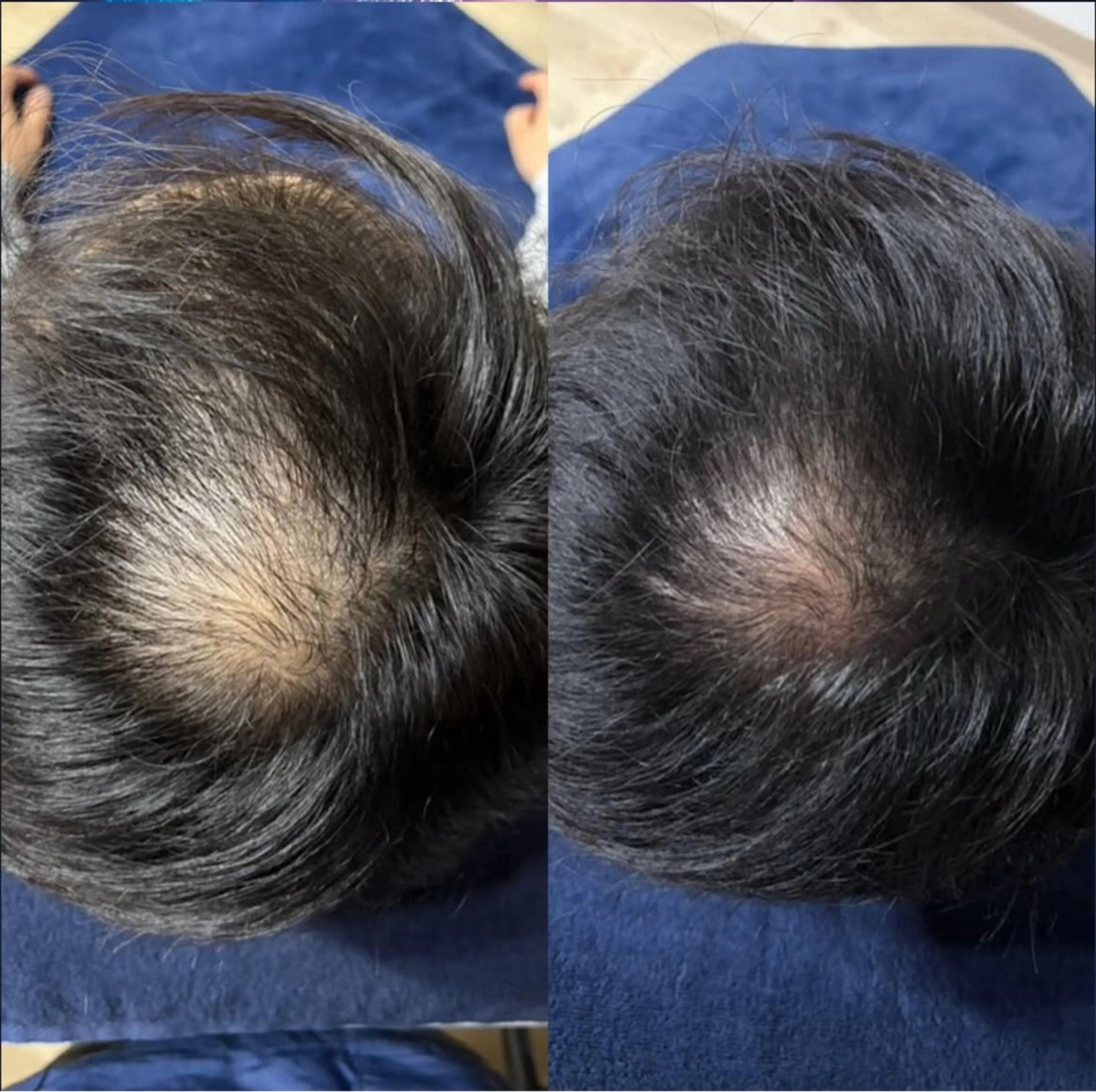 メンズ Blooming所属・LOUISE. ／肌質・頭皮のエステ・リラクイメージ