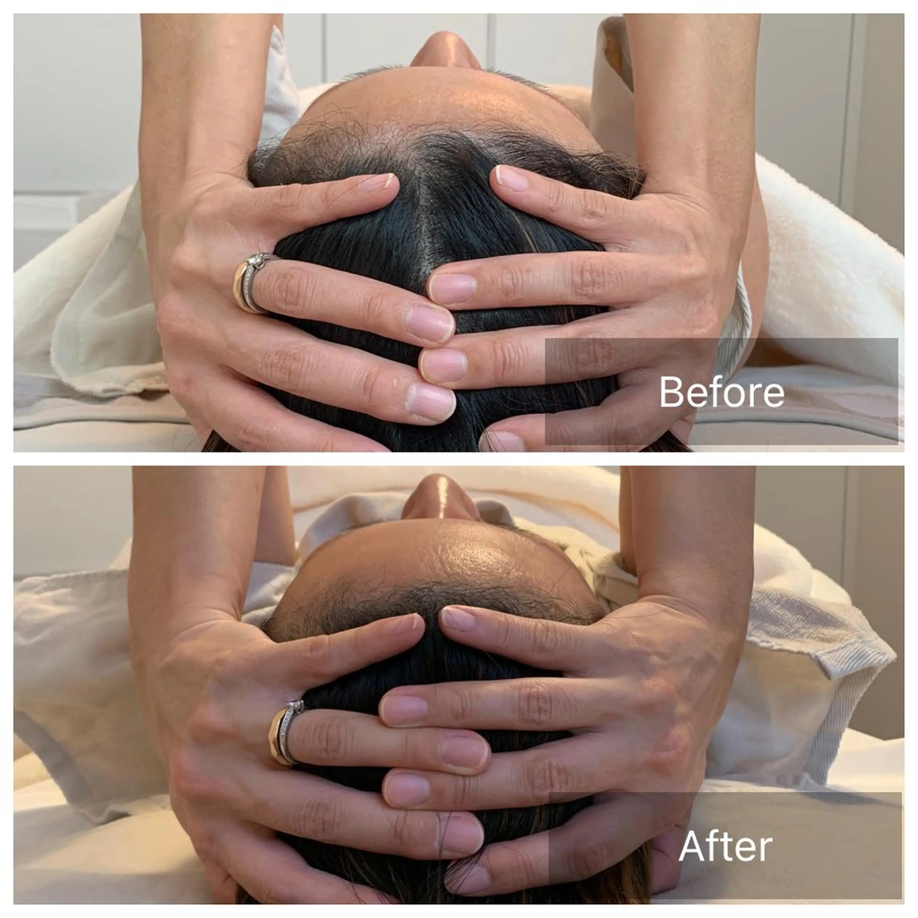 脳洗浄小顔調整オーダーメイド120分の写真