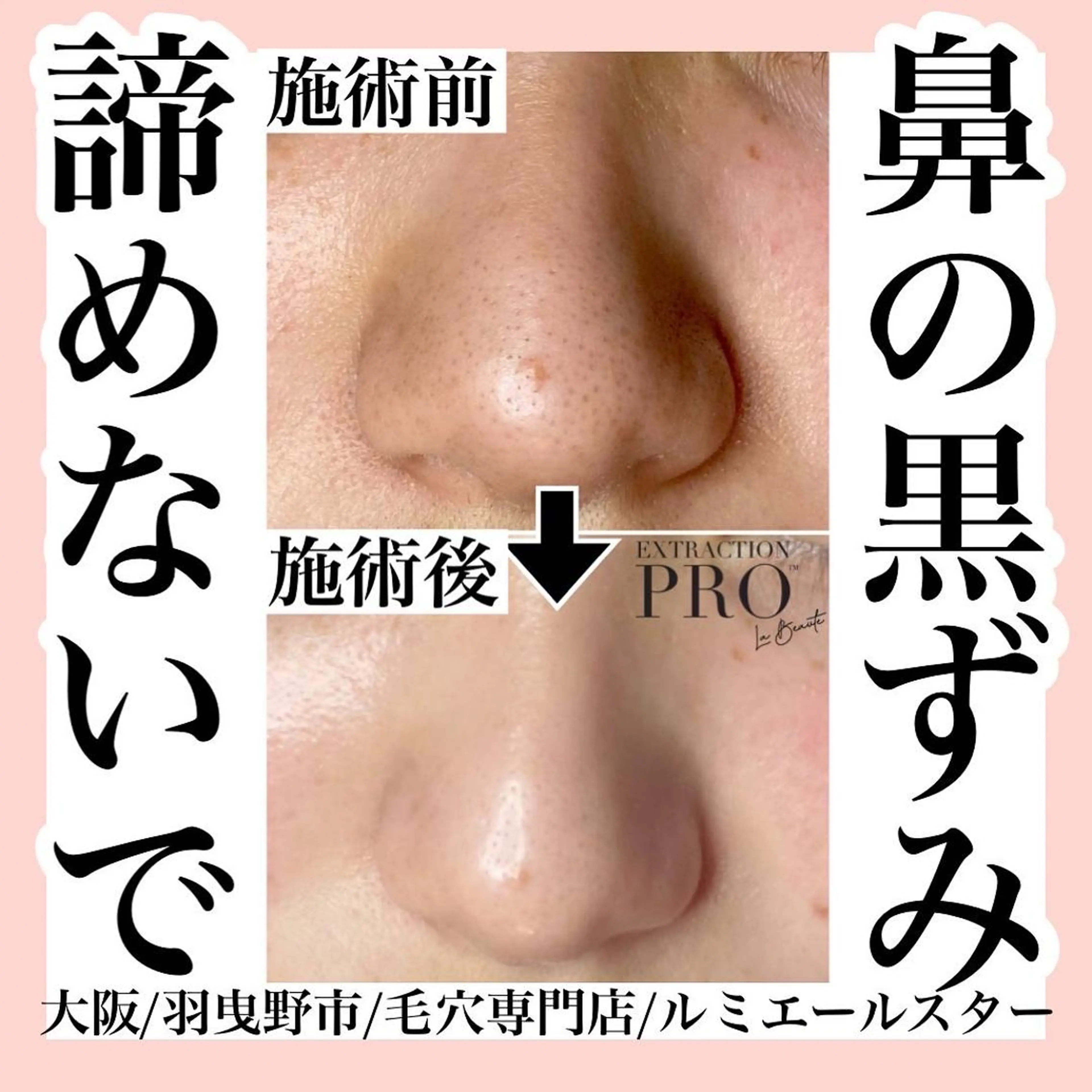 シミケア放題専門 /杉原いくえのエステ・リラクイメージ