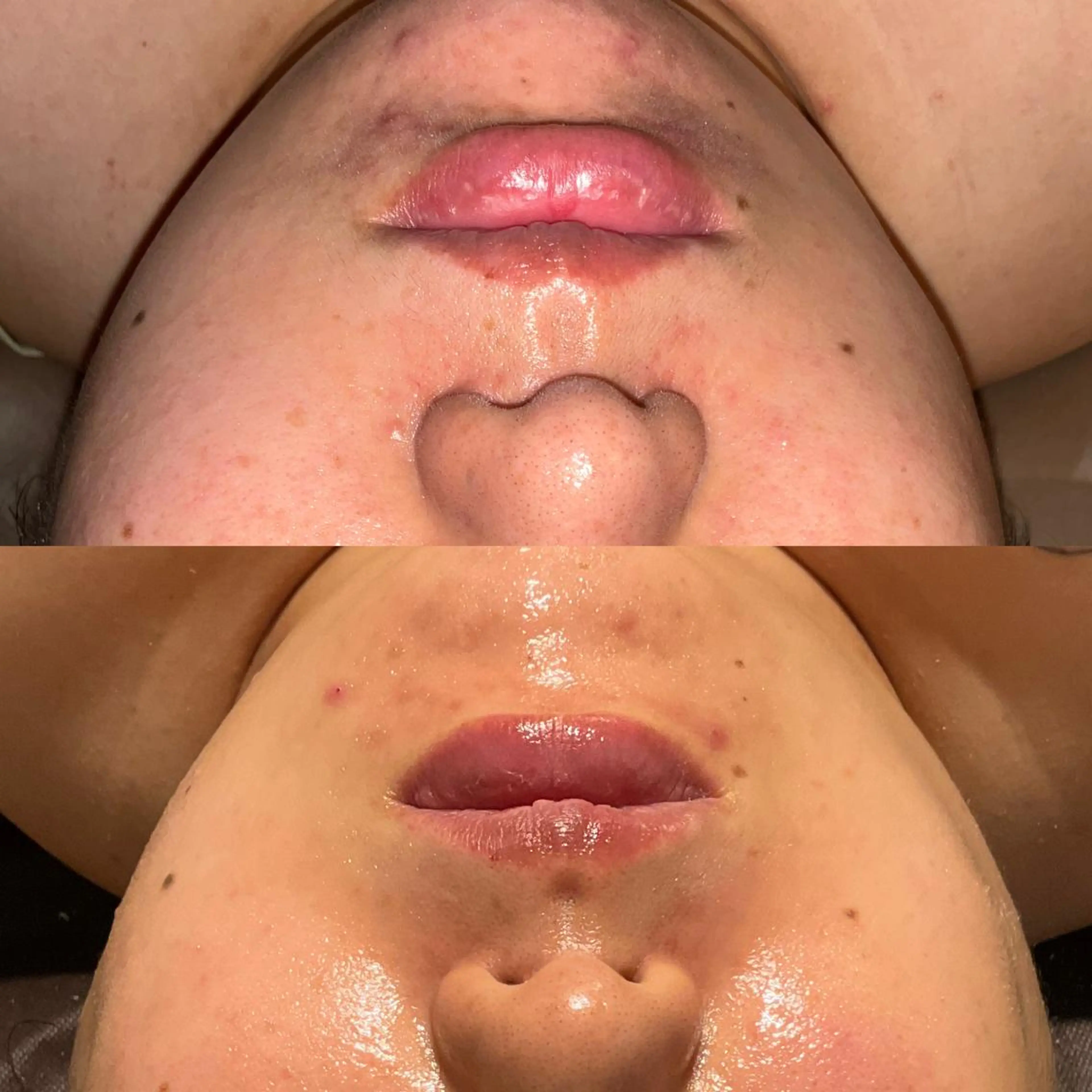 エステ 女性のお悩み美容 サロン　ヴィーナスのエステ・リラクイメージ