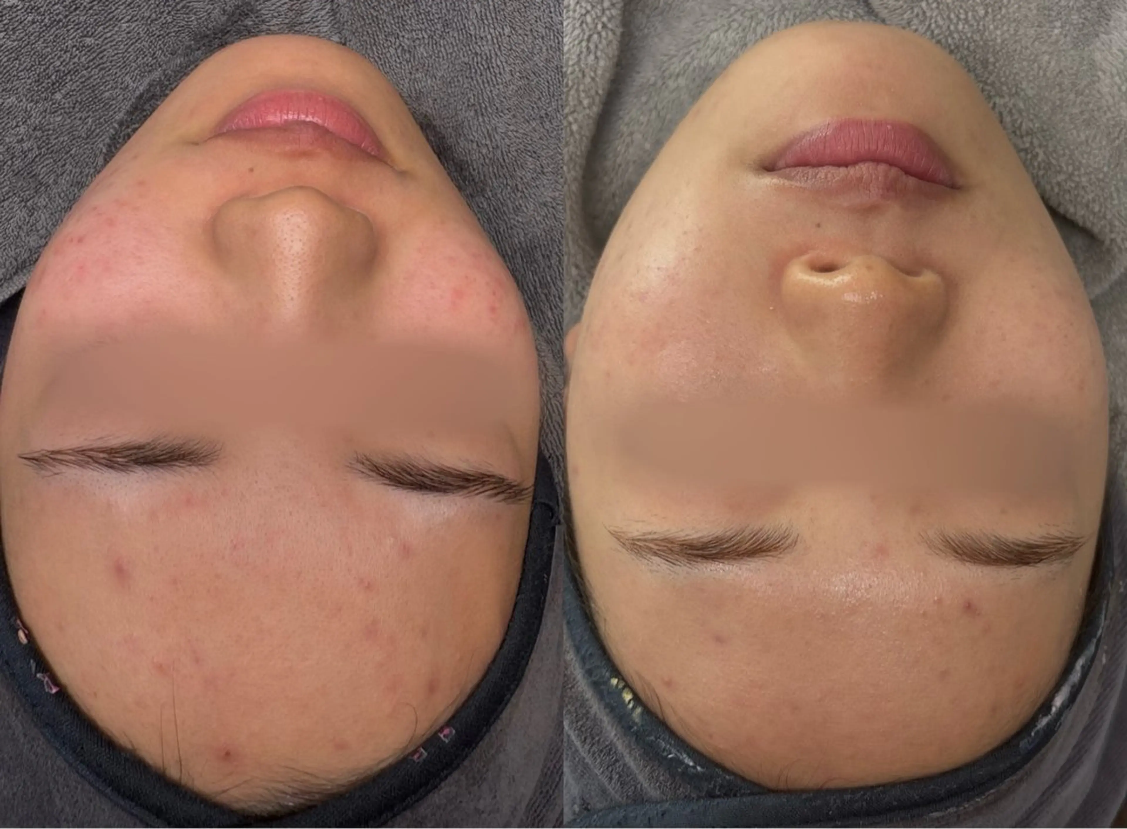 エステ Le cherienのエステ・リラクイメージ