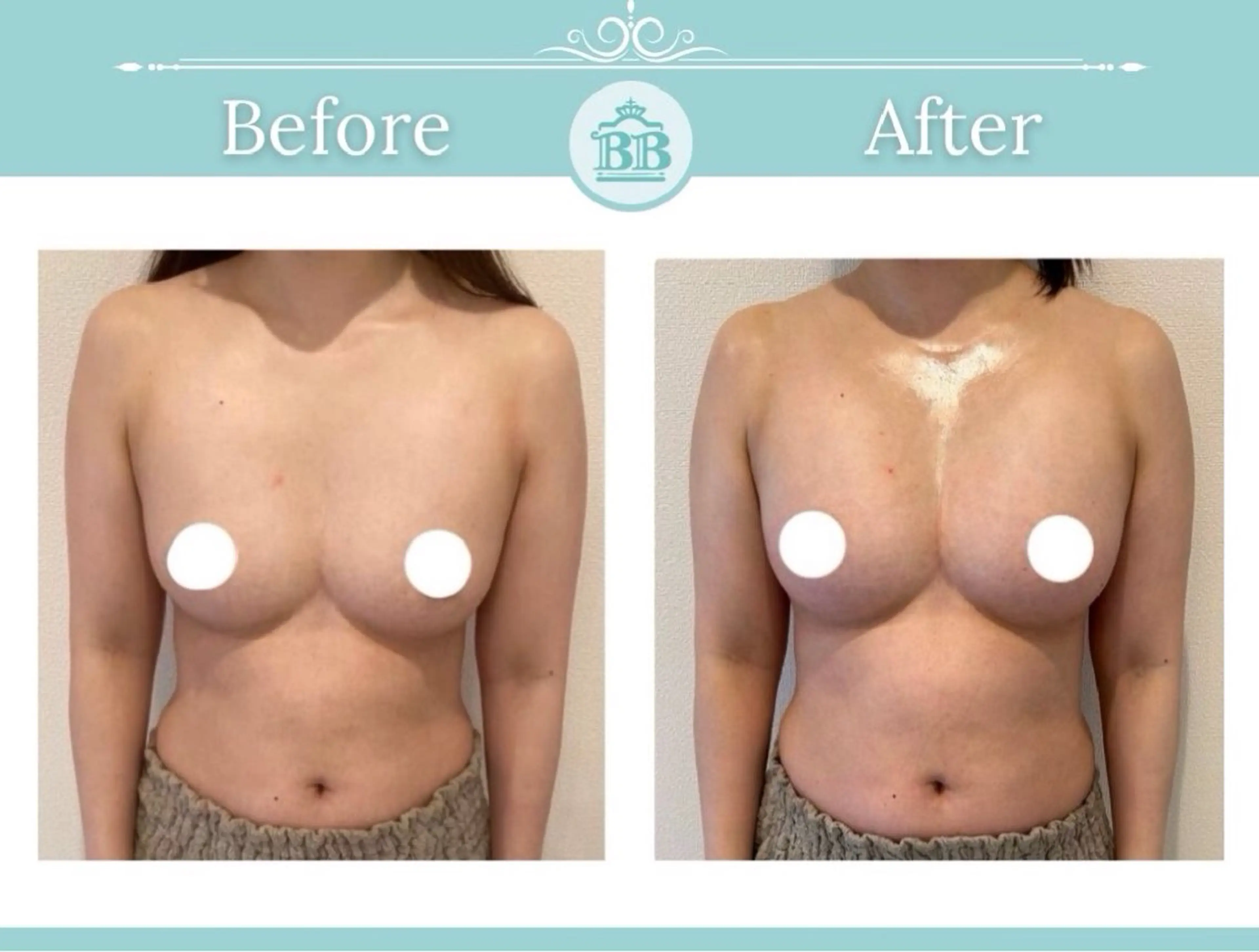 エステ 美人バスト本厚木店所属・美人バスト 本厚木店のエステ・リラクイメージ