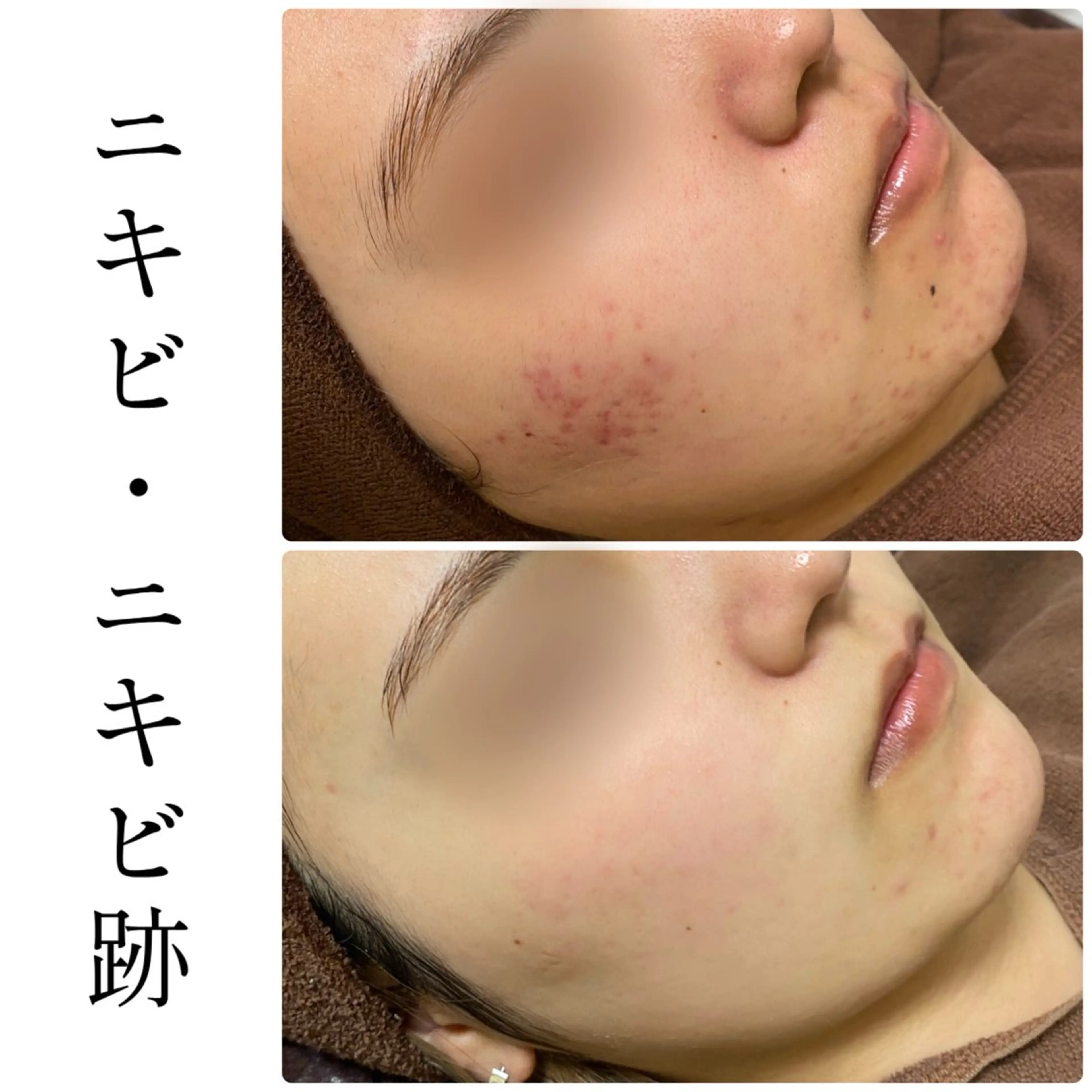 エステ ハーブピーリング専門 BIOEL横浜のエステ・リラクイメージ