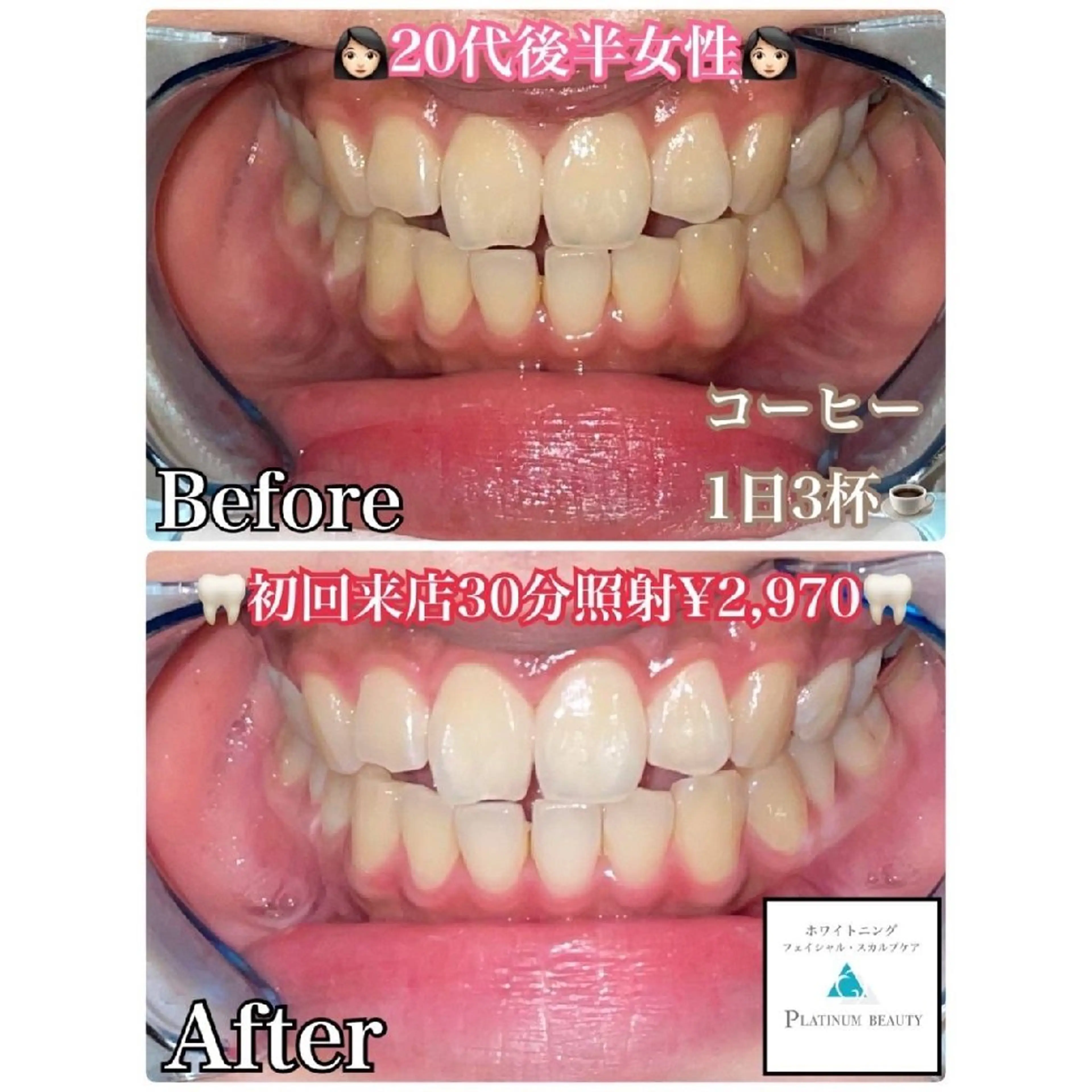 セルフホワイトニングビューティー三川店所属・中村 江梨香のその他イメージ