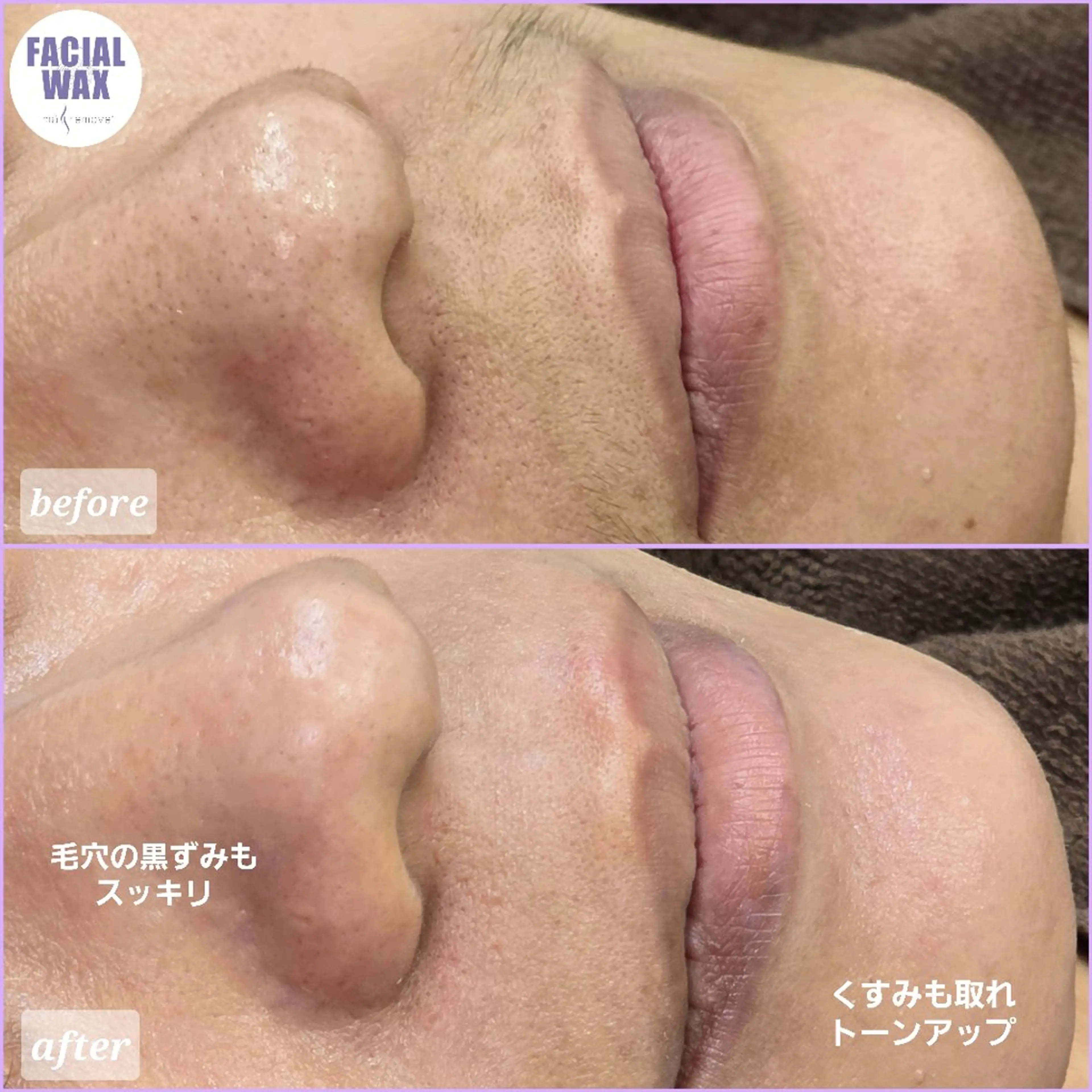 エステ facial salon Lily所属・salon Lilyのエステ・リラクイメージ