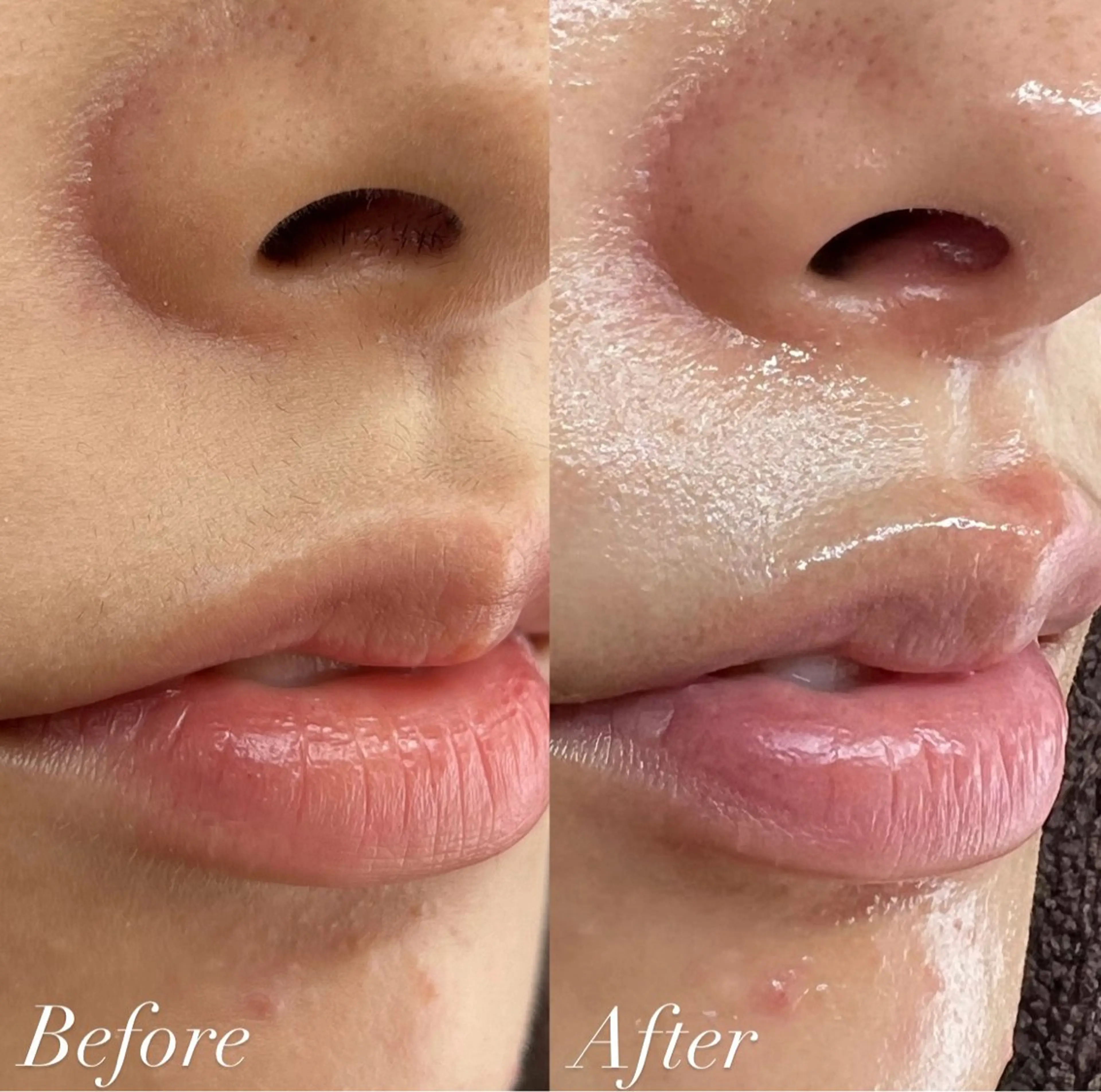 Cheri所属・丸山 彩乃のエステ・リラクイメージ