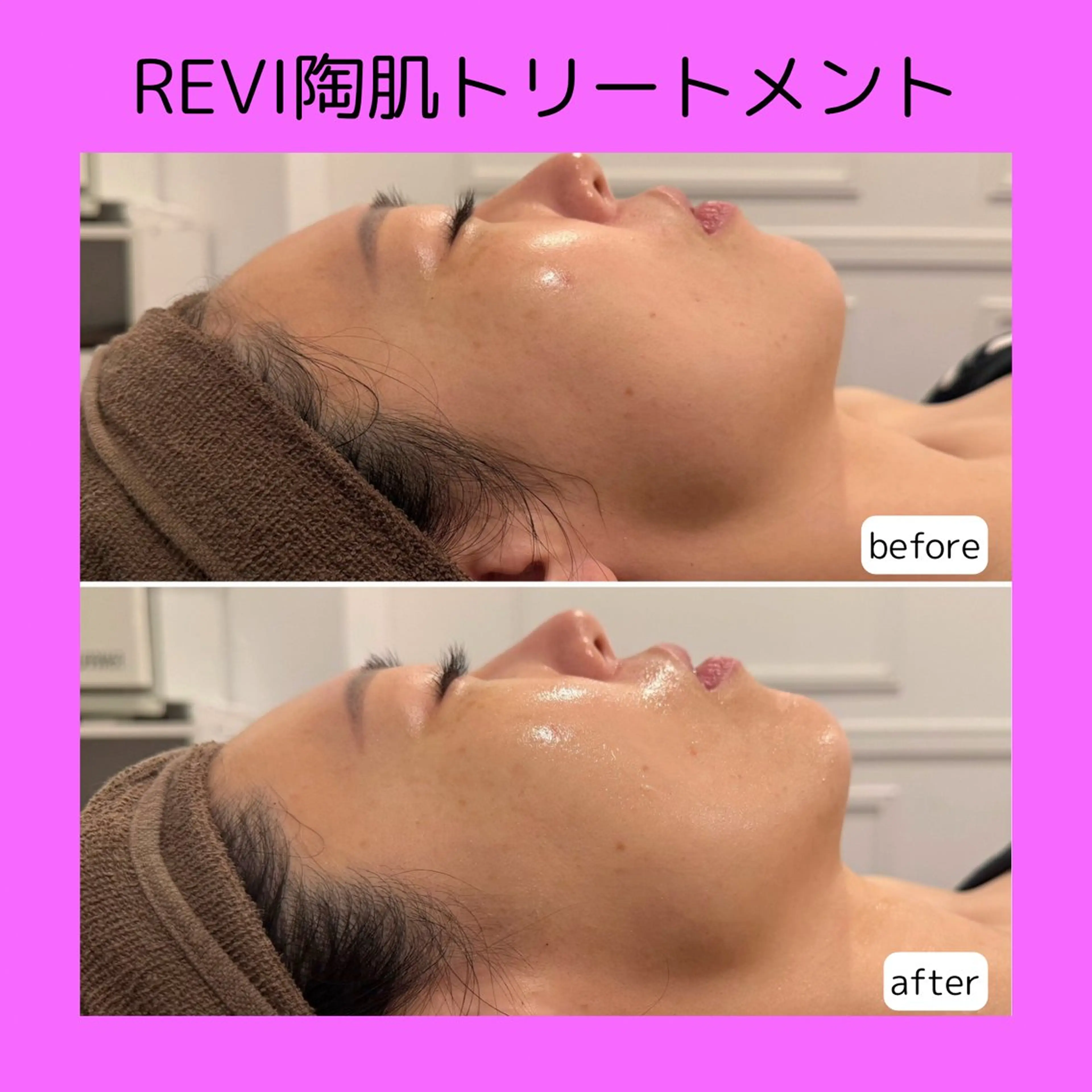 赤澤/本気痩せ・脱毛 ・ノーファンデ肌のその他イメージ