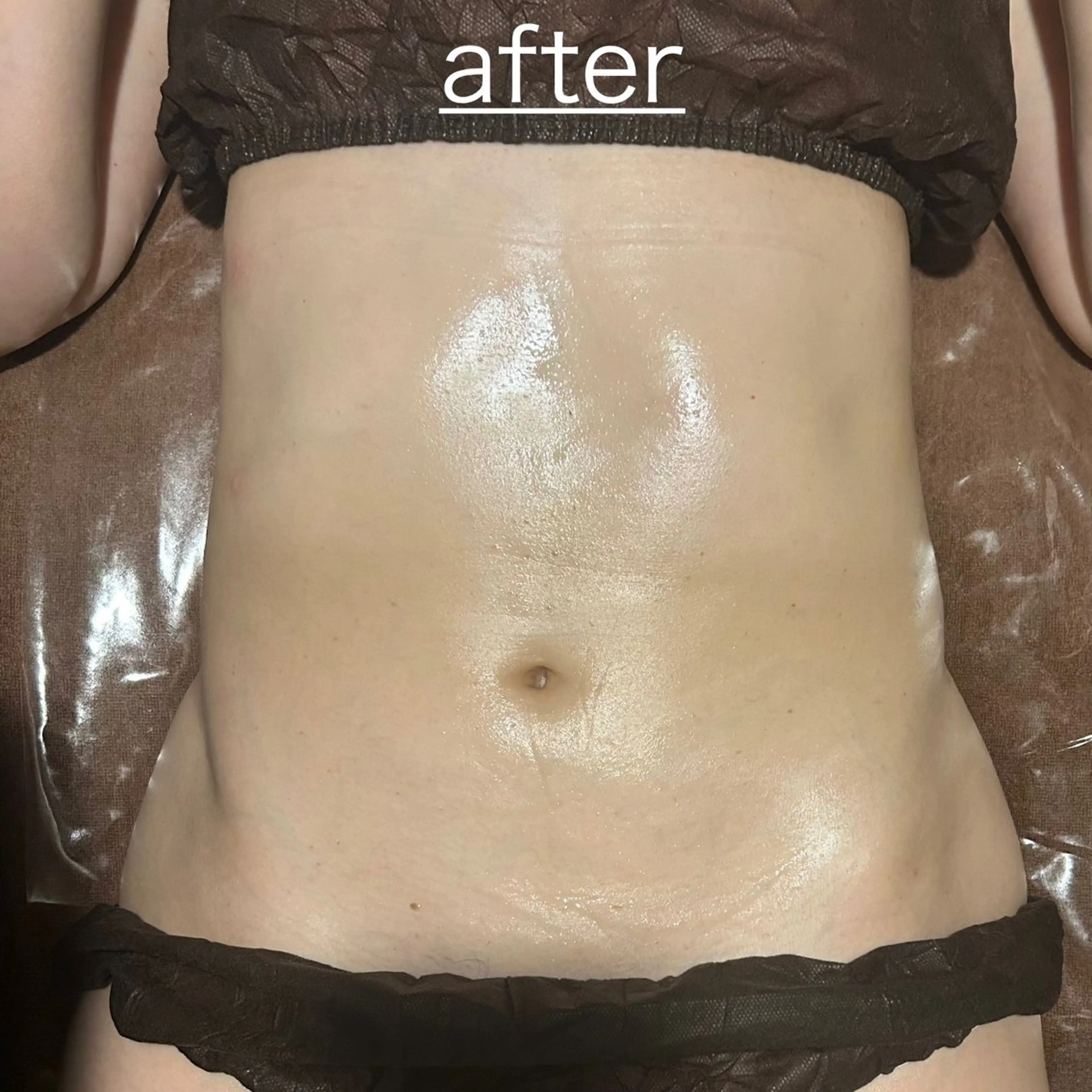 PIUMA 筋膜リリース・リンパのエステ・リラクイメージ