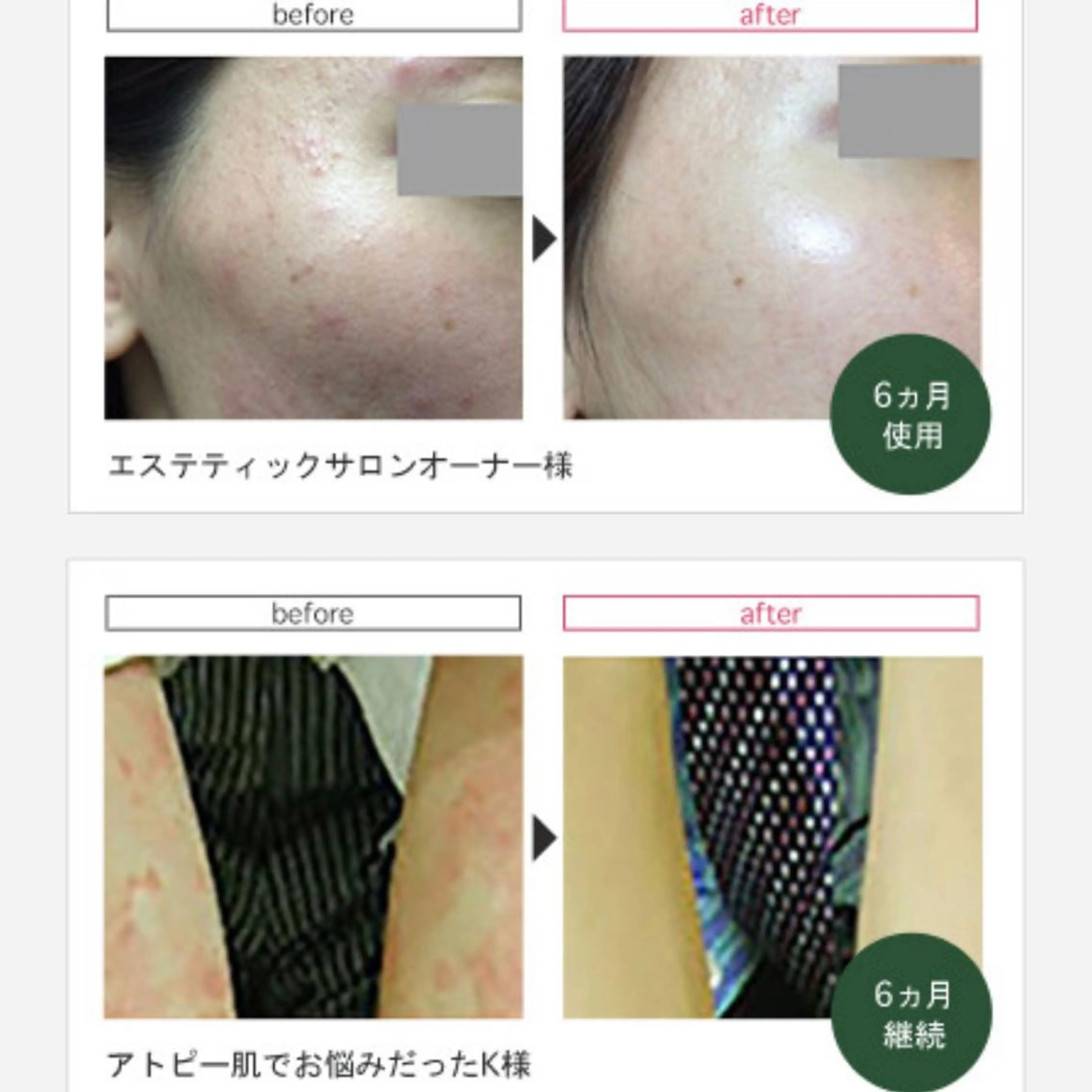 LEA MUSASHIKOSUGI所属・美肌育成サロン LEA武蔵小杉のエステ・リラクイメージ