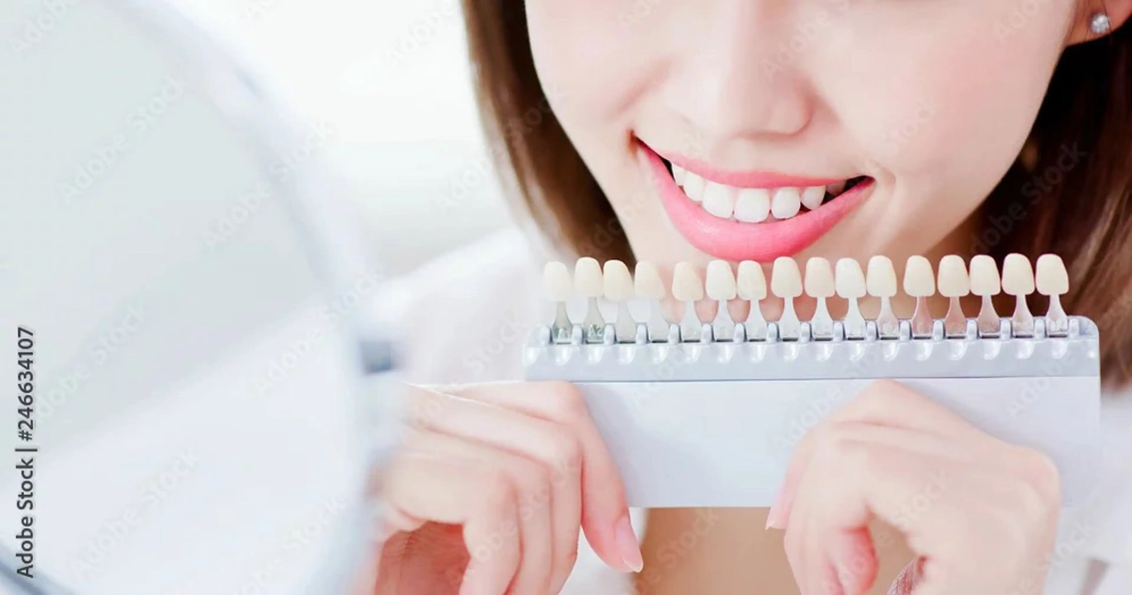 【ご新規様限定🦷】自信を持てる歯へ✨セルフホワイトニングの写真