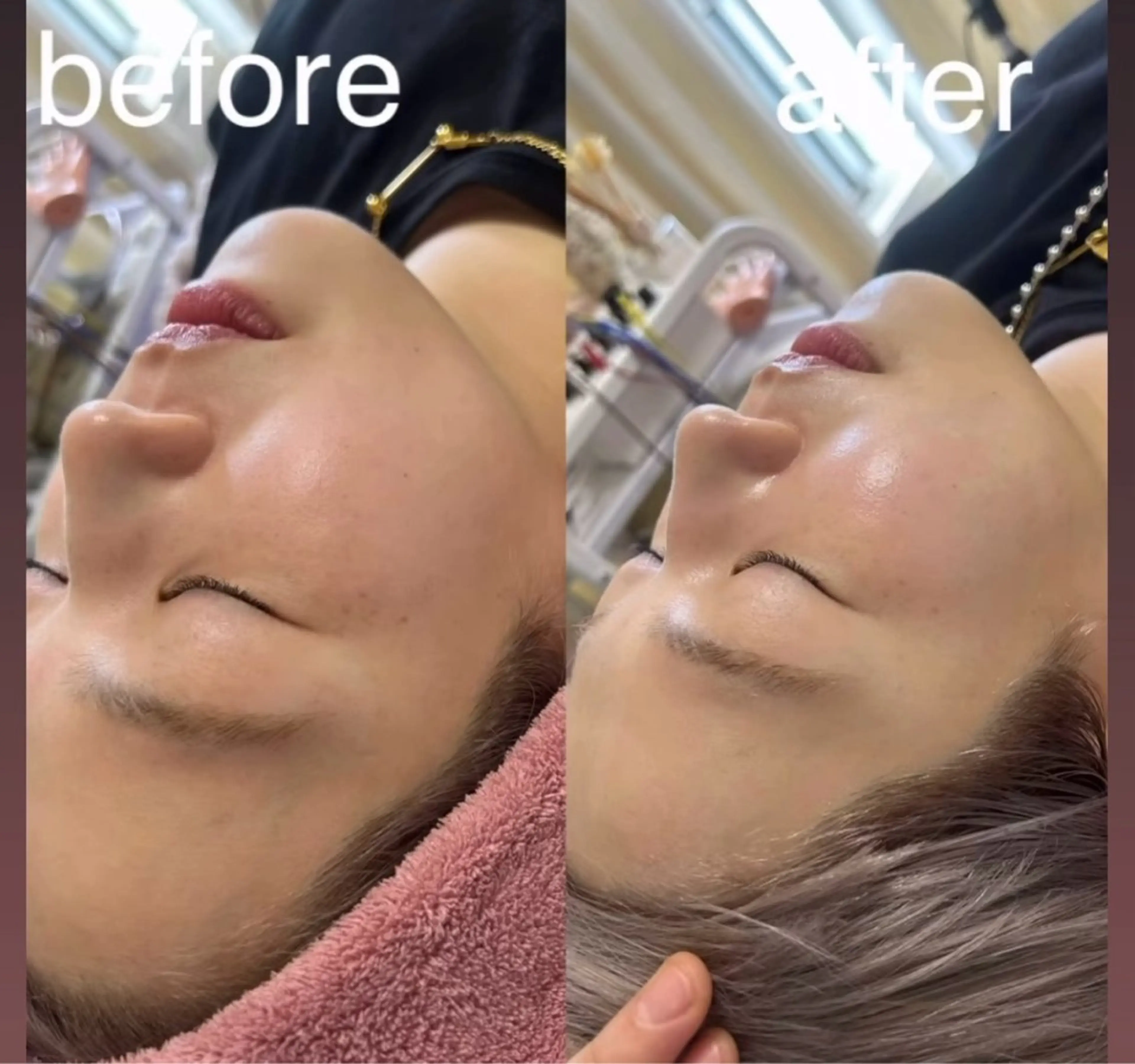 エステ リラク 美容鍼灸サロン mahoroba院長のエステ・リラクイメージ