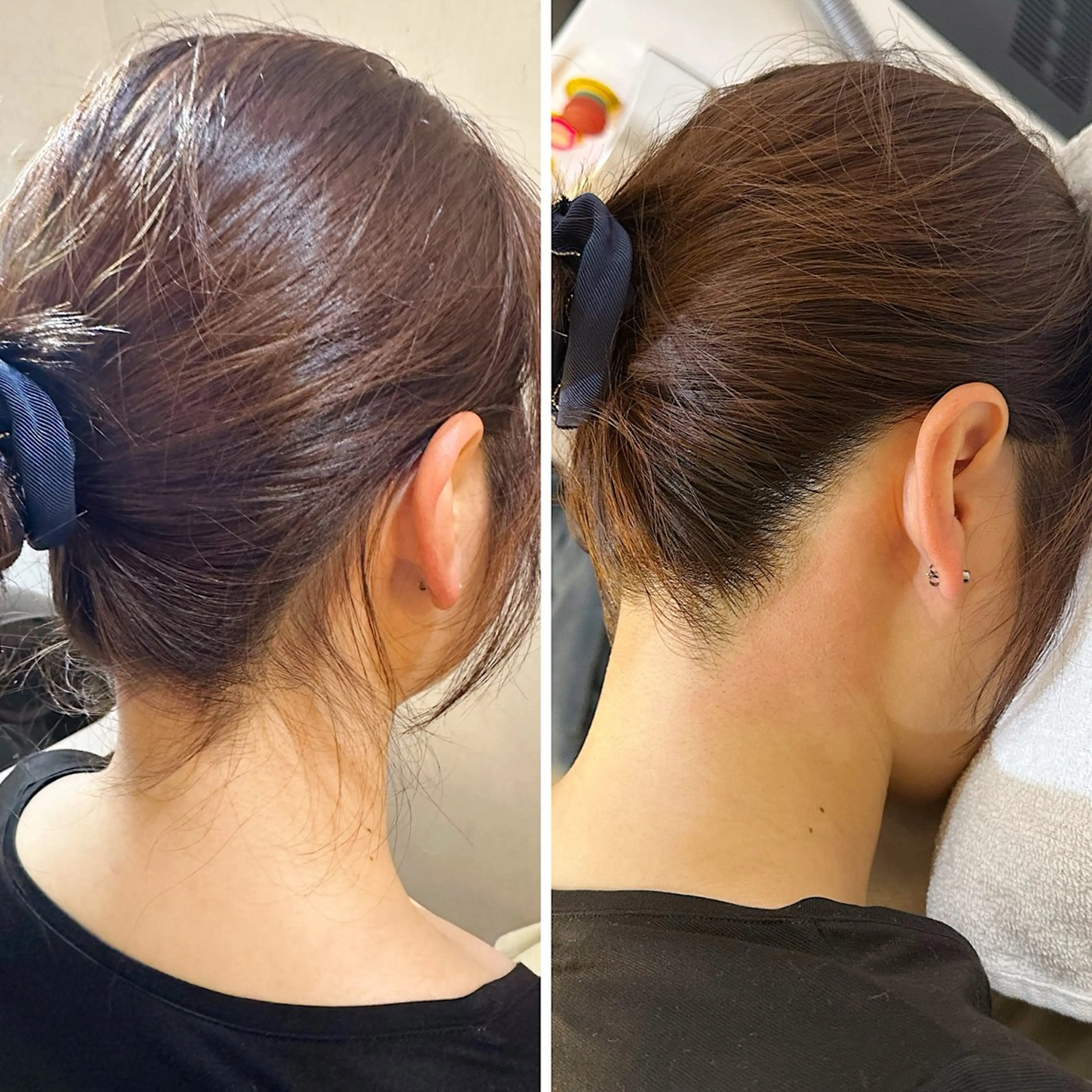 脱毛 うなじ脱毛/美肌脱毛 LABELのエステ・リラクイメージ