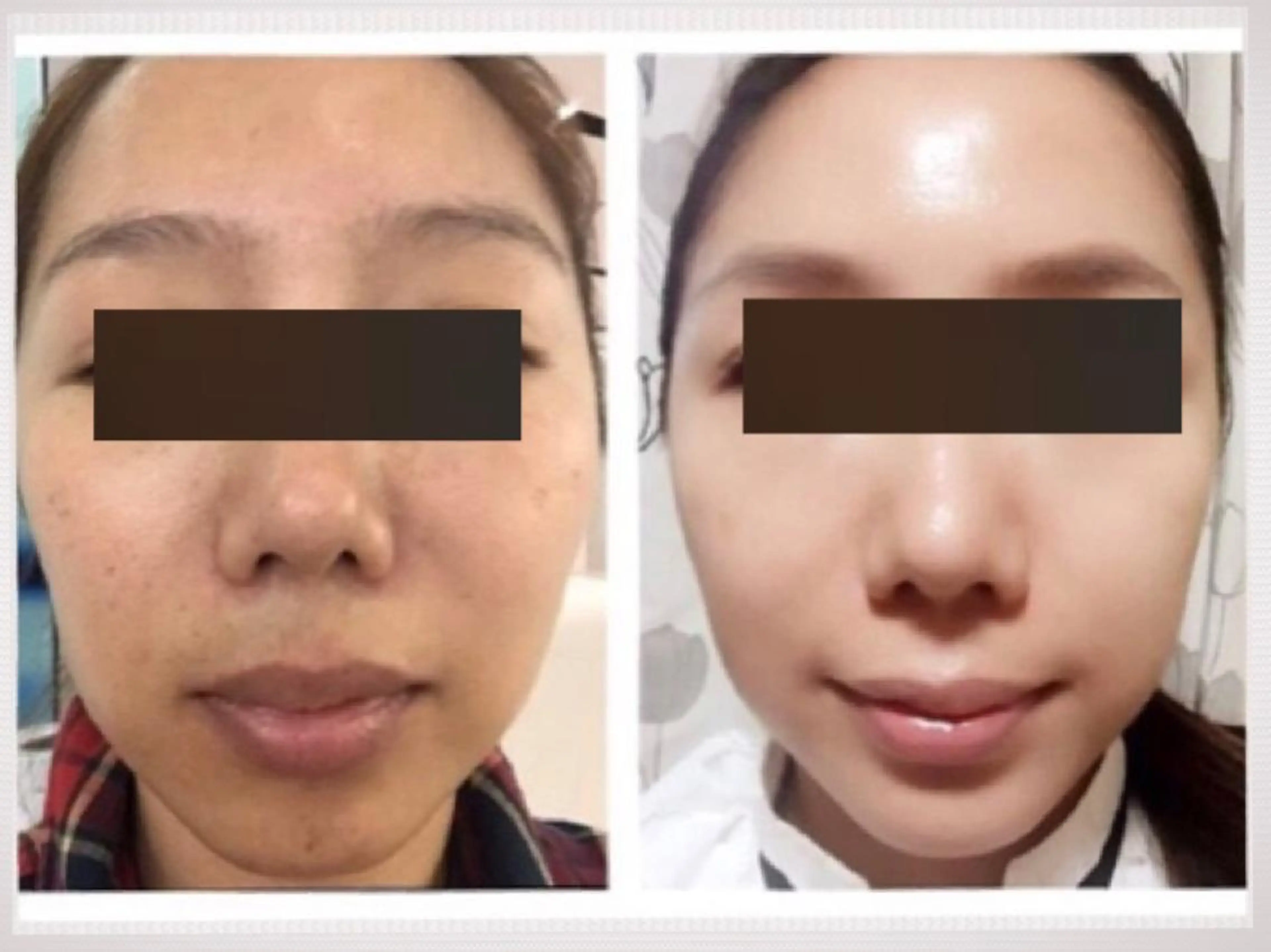 1番人気💝【乾燥肌向け♪極潤保湿・ぷるぷる美肌】フェイシャルコース　60分の写真