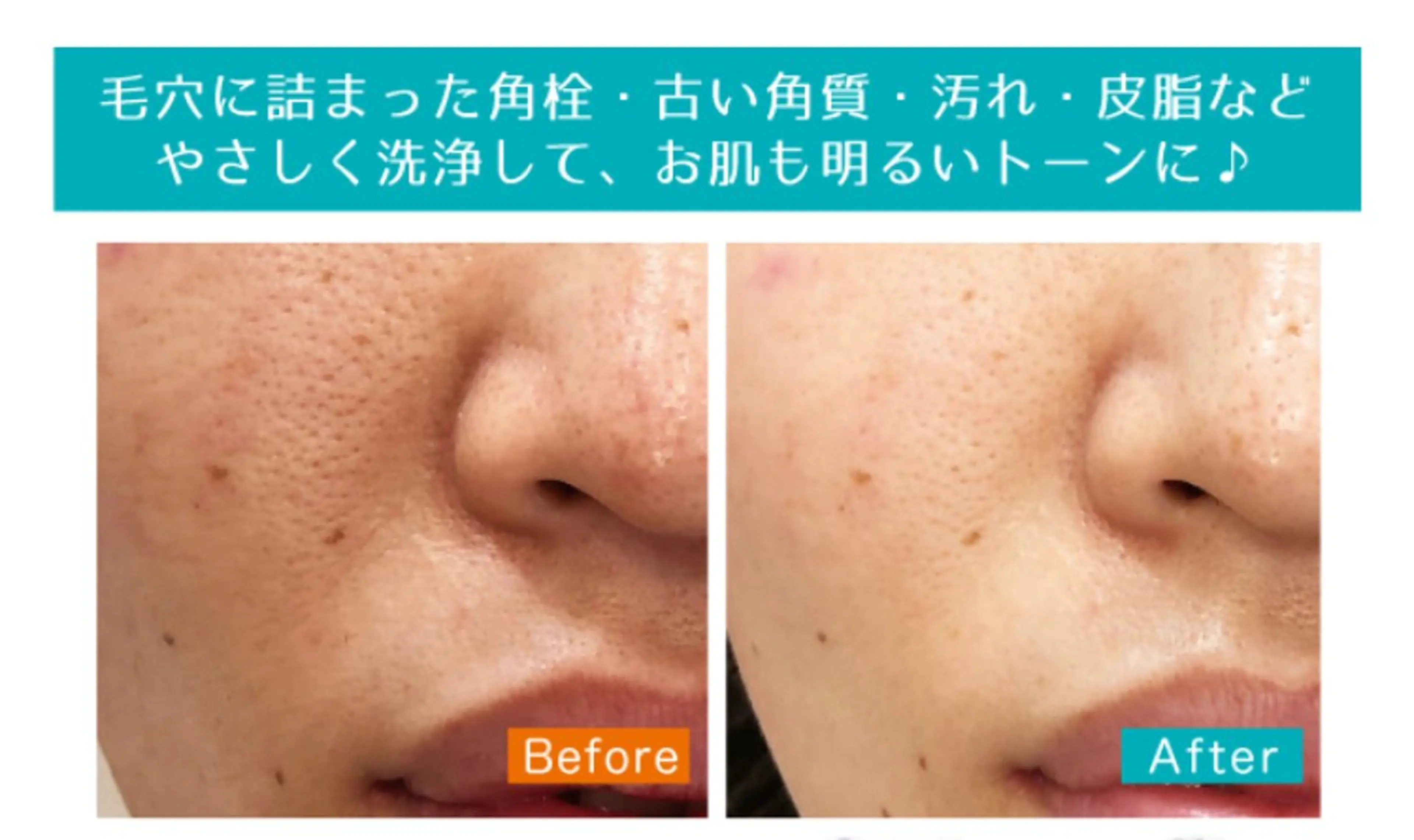 eclair エクレイルのエステ・リラクイメージ