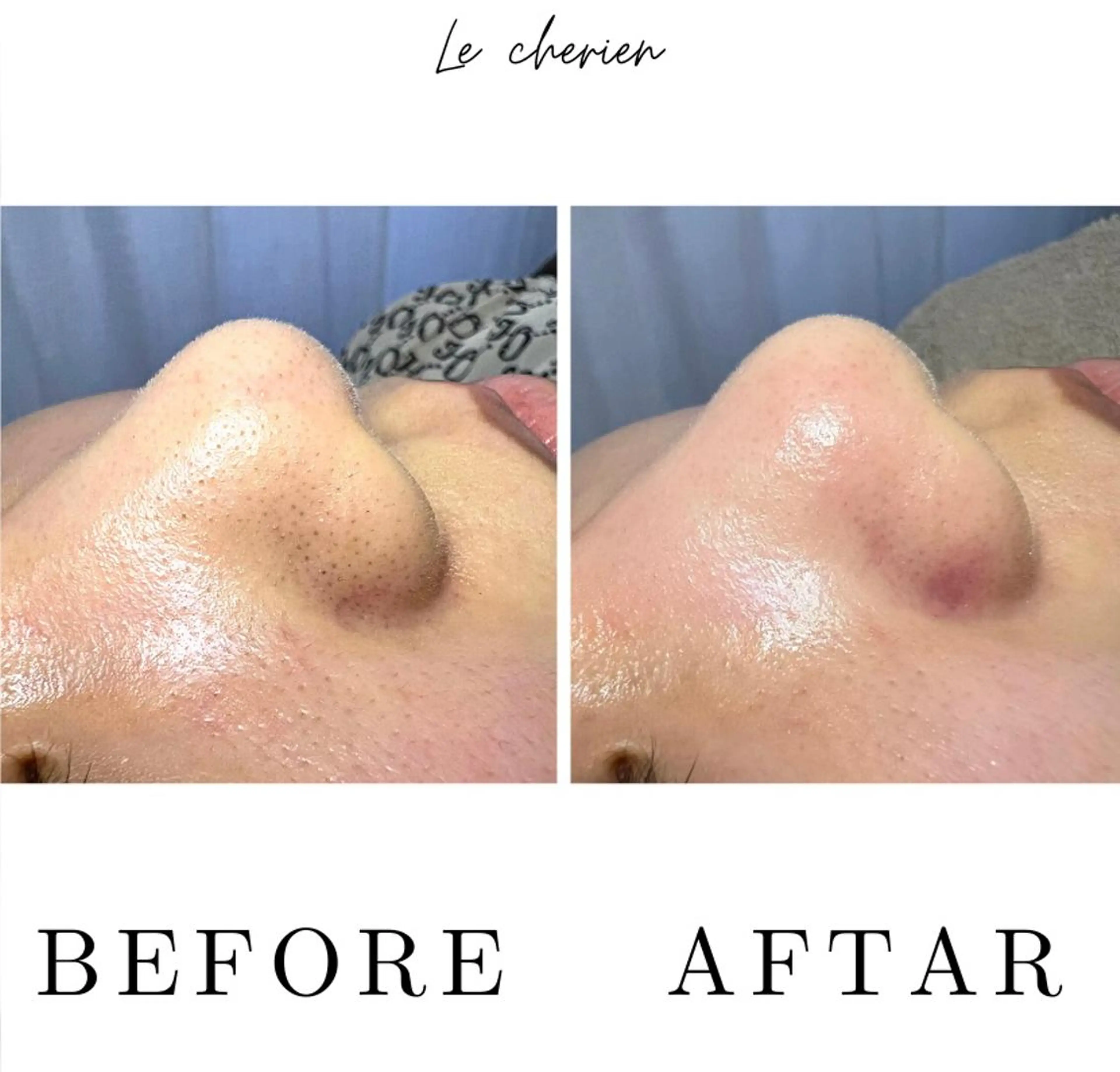 Le  cherien ル シェリア所属・毛穴洗浄/ハイフ サロンのエステ・リラクイメージ