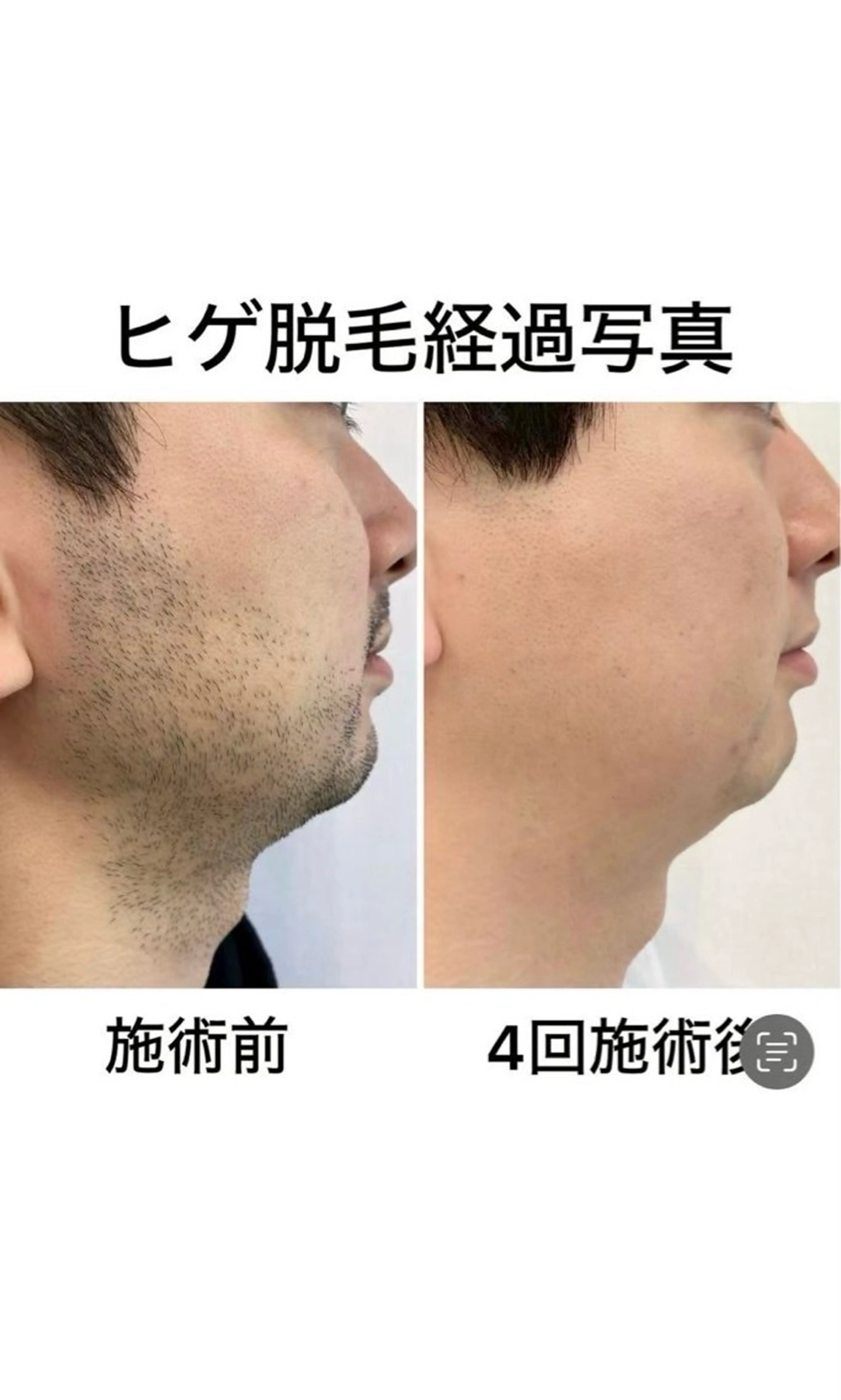 脱毛 Beauty Salon VELLA所属・VELLA sanaのエステ・リラクイメージ