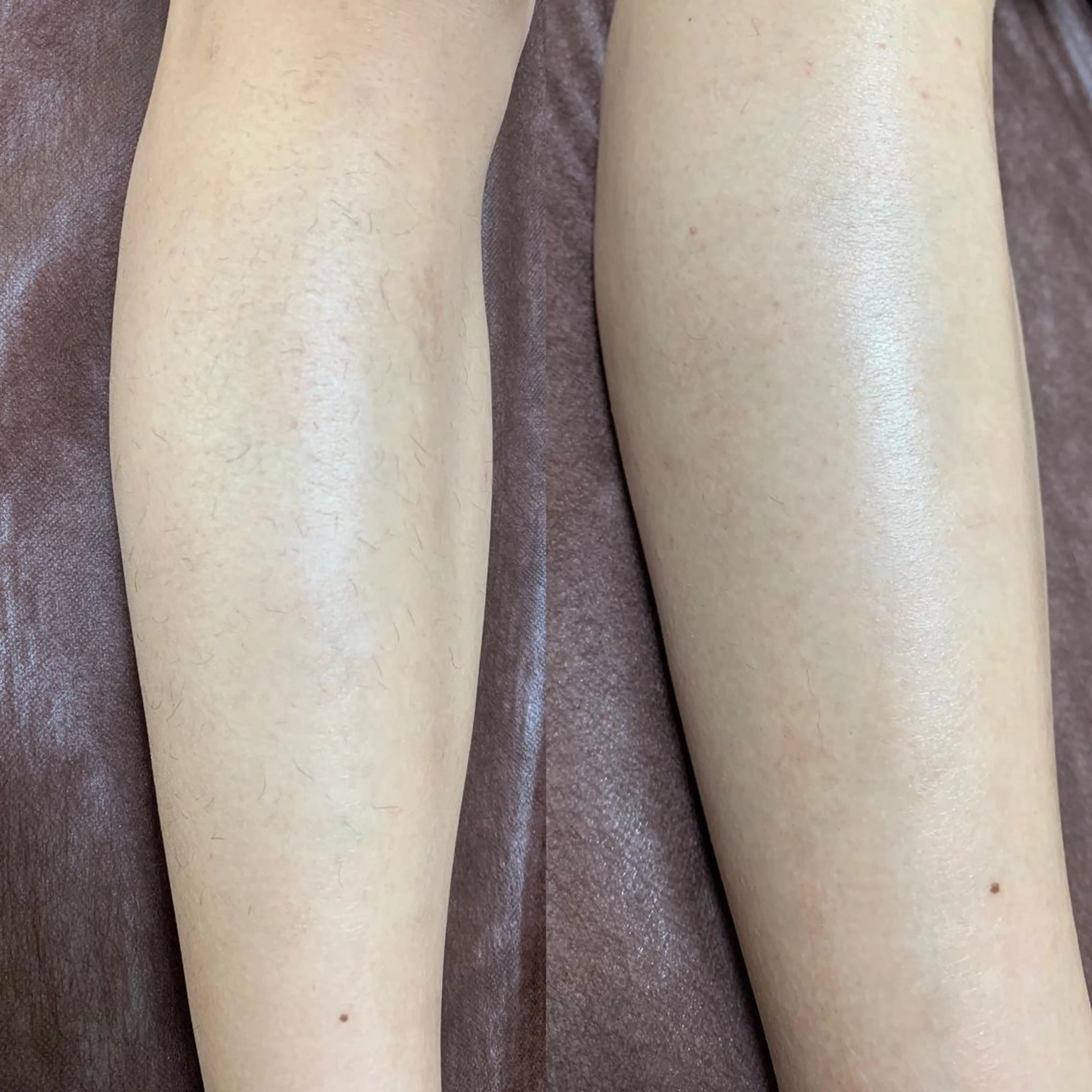 メンズ 脱毛SALON RaYNiCKのエステ・リラクイメージ