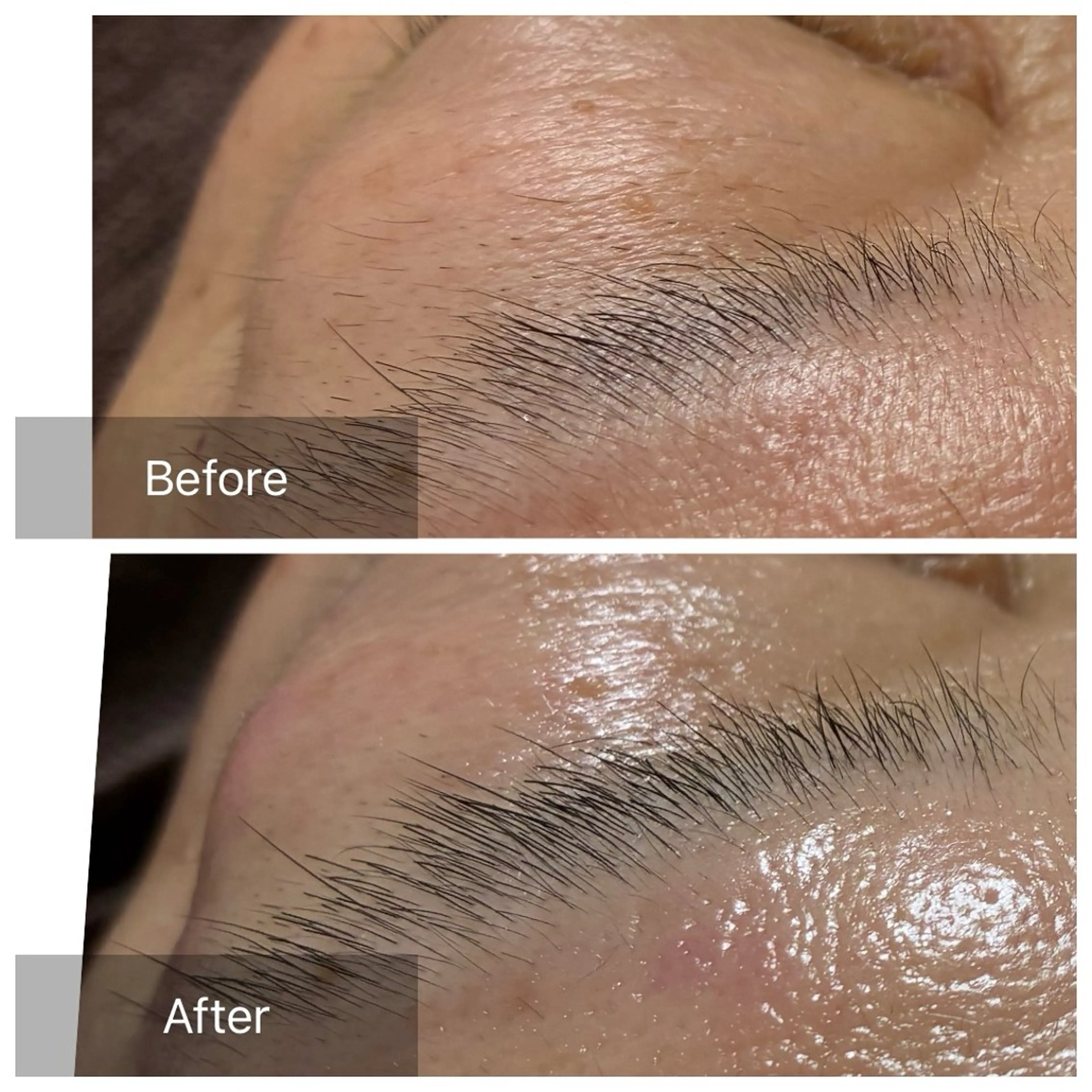 脱毛 産毛専門店 Bittoのエステ・リラクイメージ