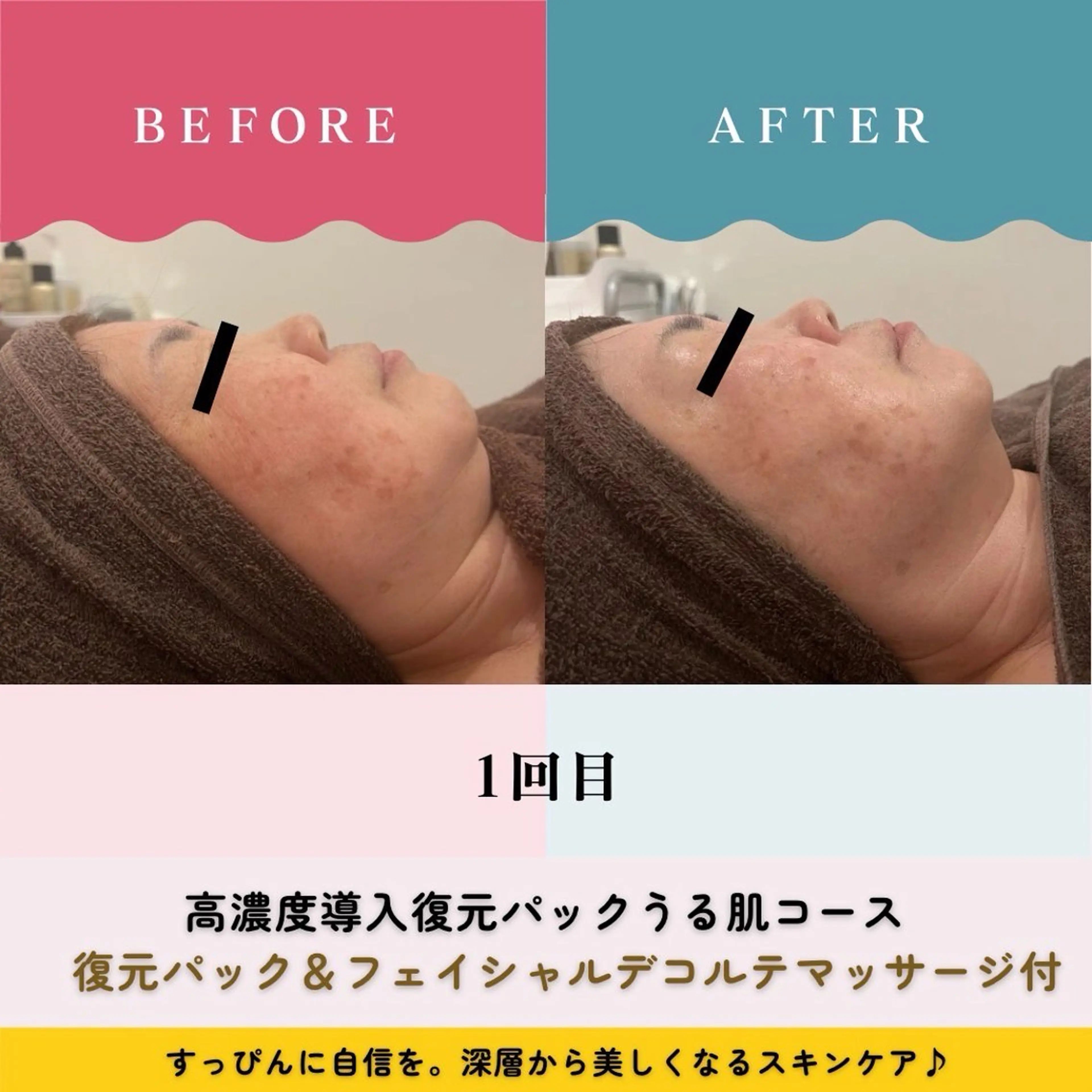 【毛穴・たるみ・美白・むくみ・シミ・シワに最適👍)真夏の日差し負けないお肌に🌟磁気復元パックケアの写真