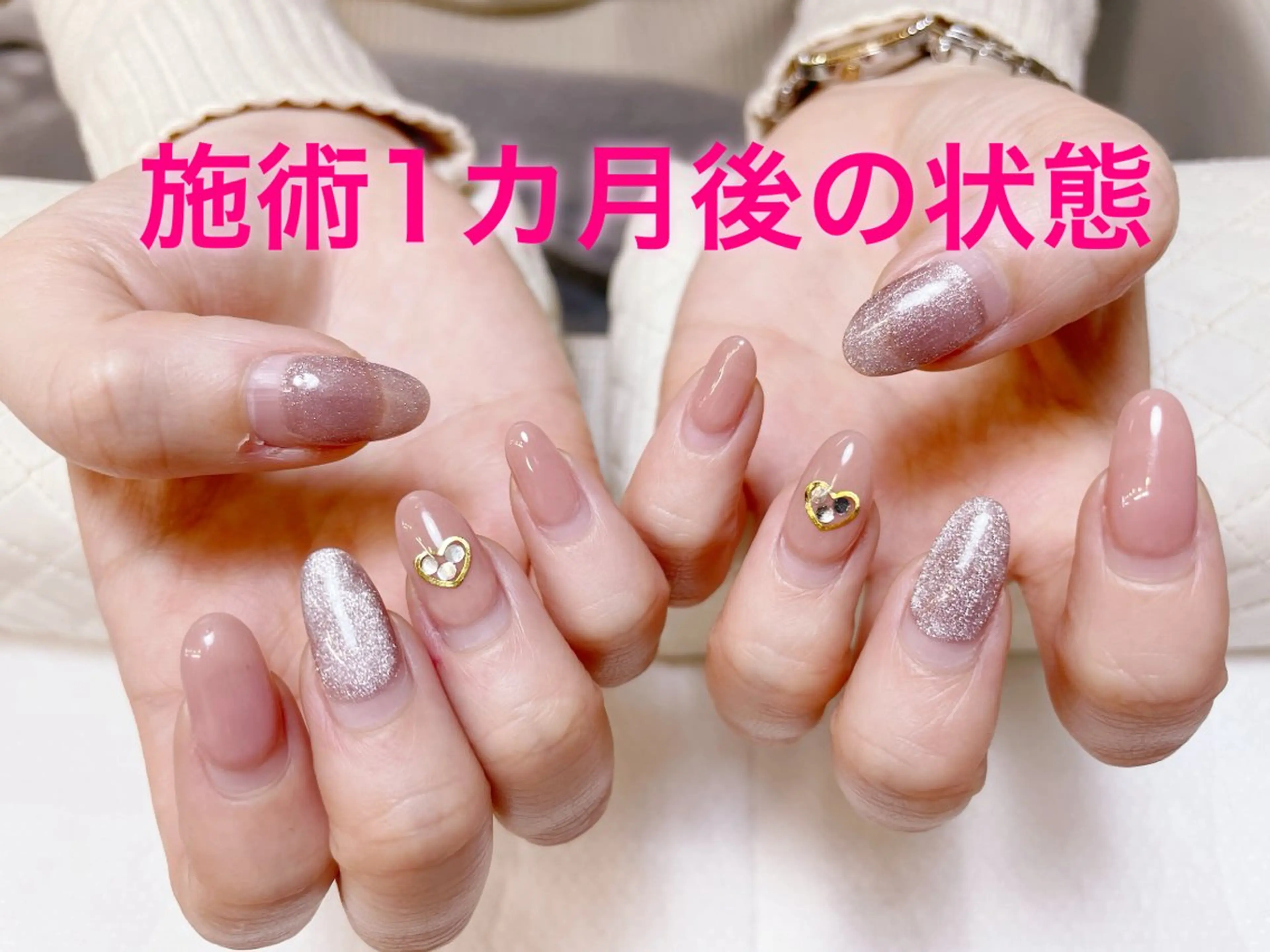 ネイル ちー 💛のネイルデザイン