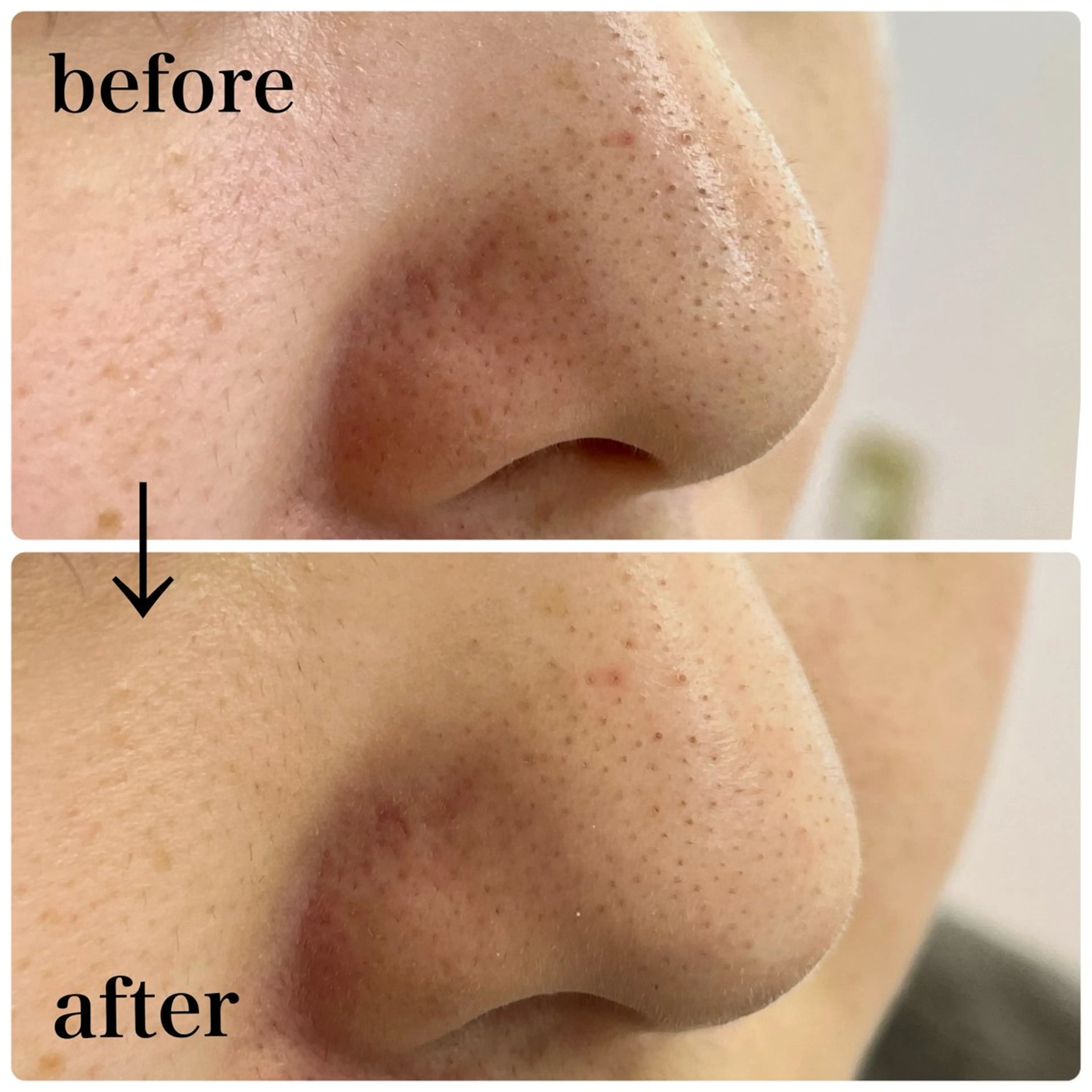 いおもり あやかのエステ・リラクイメージ