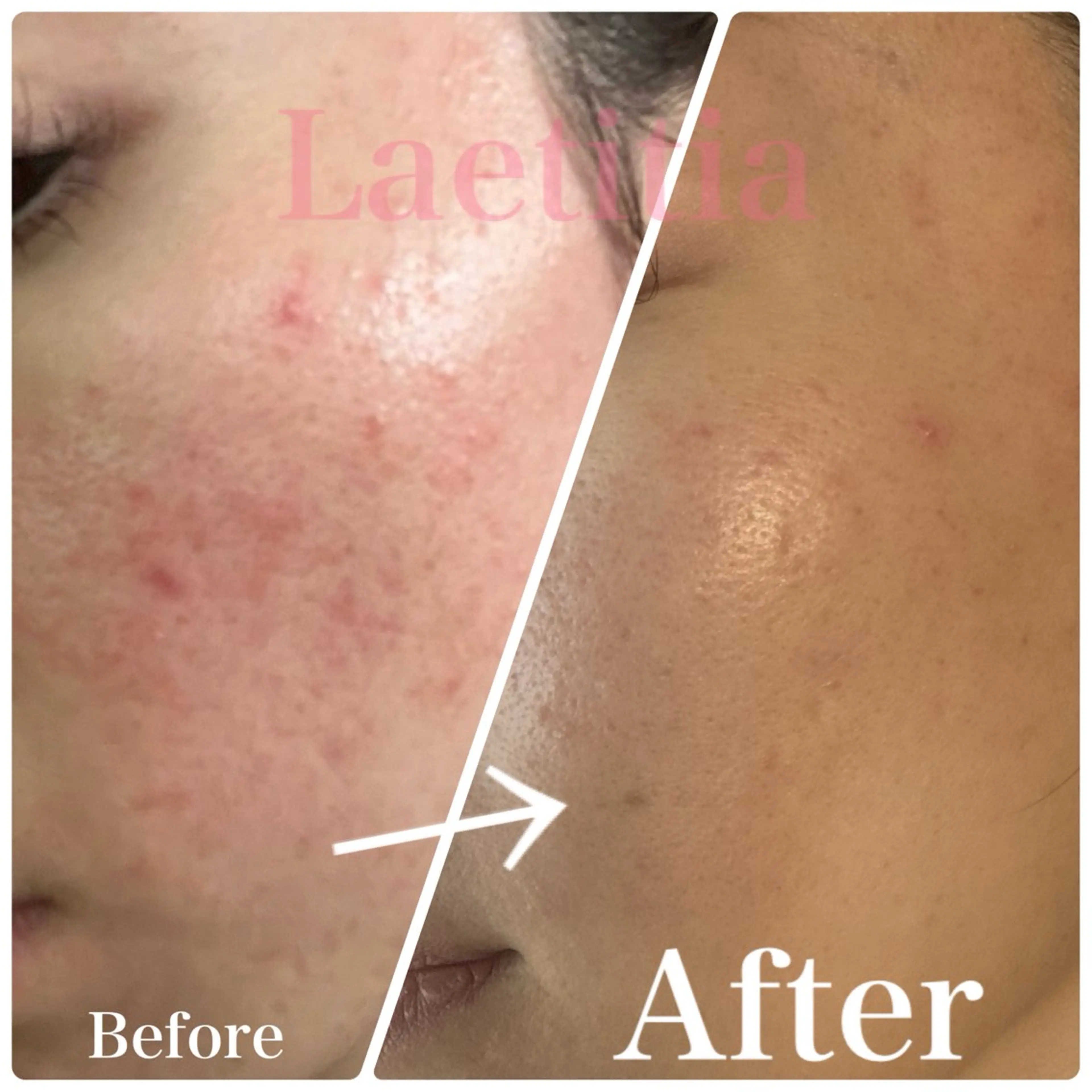 エステ レティティア【Laetitia】所属・レティティア秋葉原店 Yoshizawaのエステ・リラクイメージ